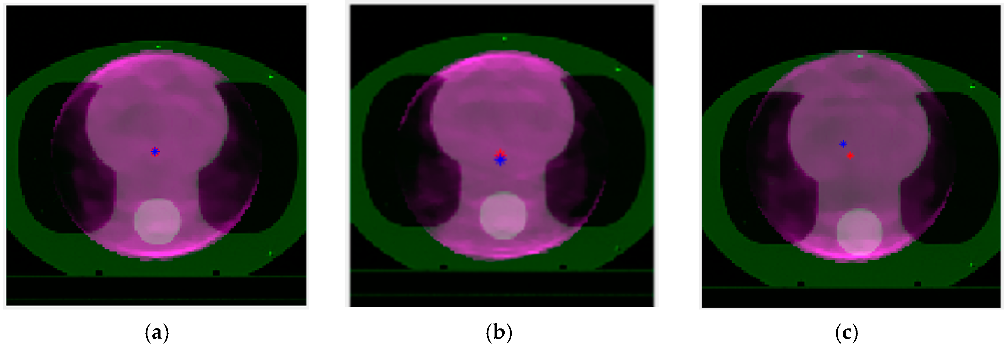 Diagnostics 14 00482 g009