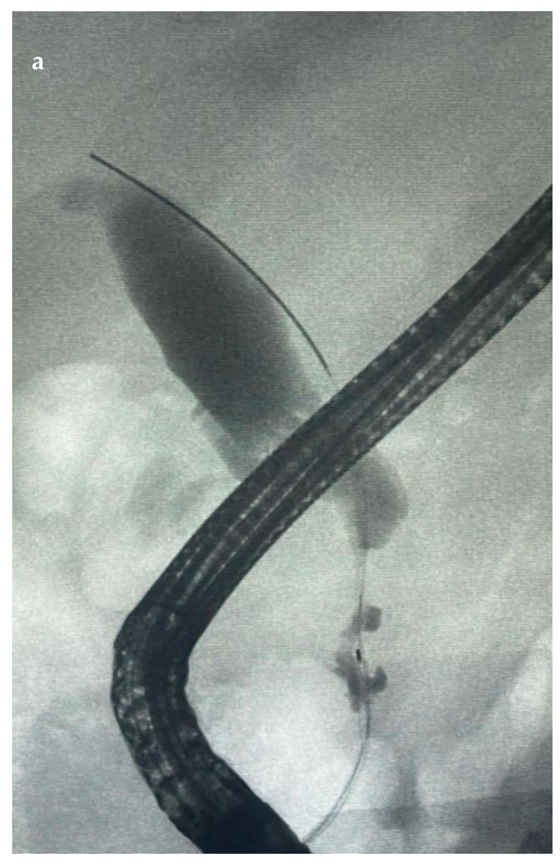 Diagnostics 14 00490 g003a