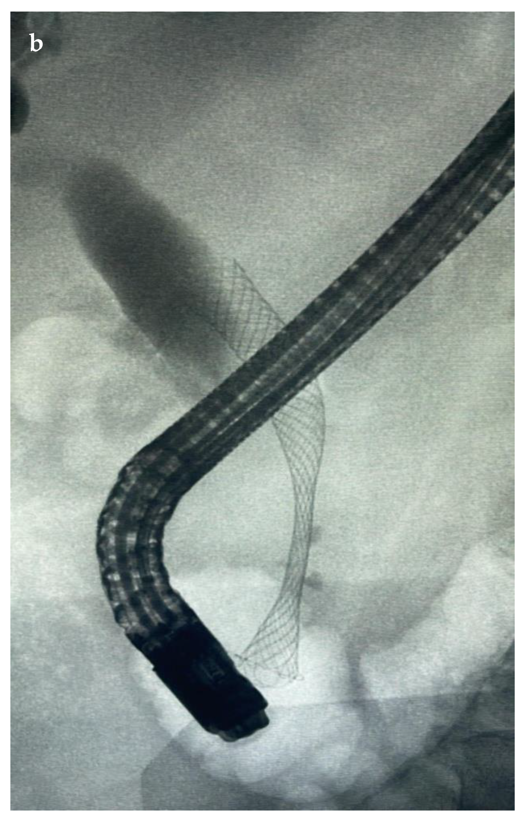 Diagnostics 14 00490 g003b