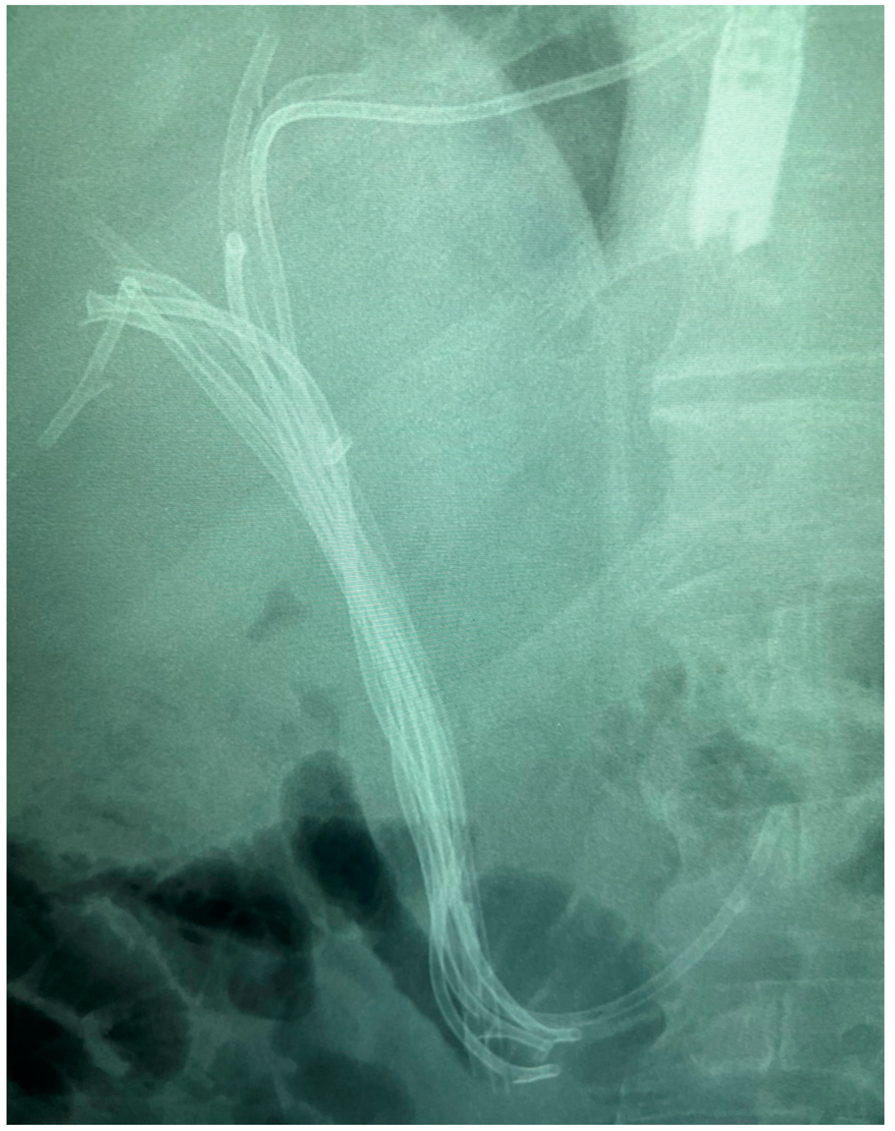 Diagnostics 14 00490 g004