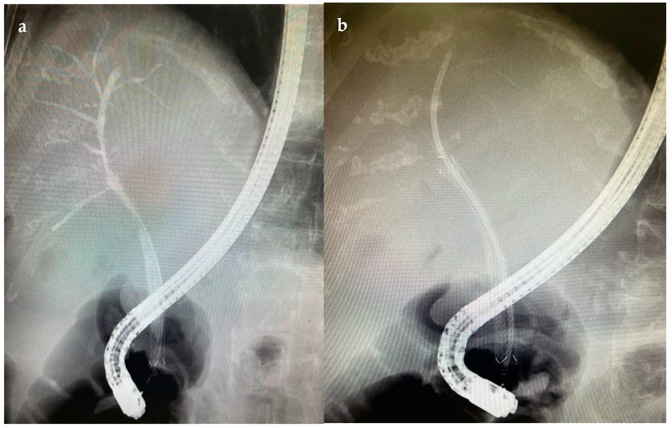 Diagnostics 14 00490 g005