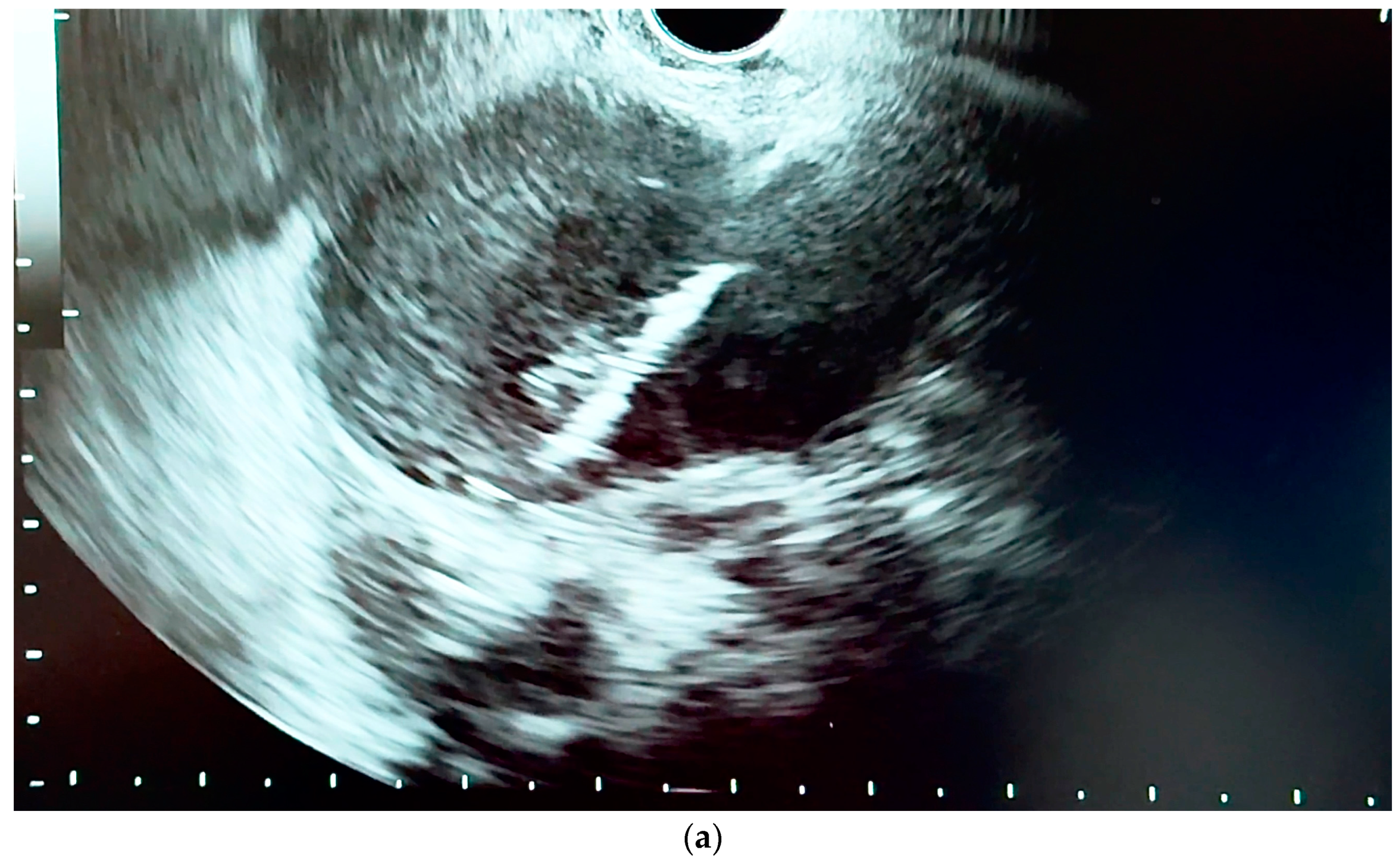 Diagnostics 14 00490 g008a