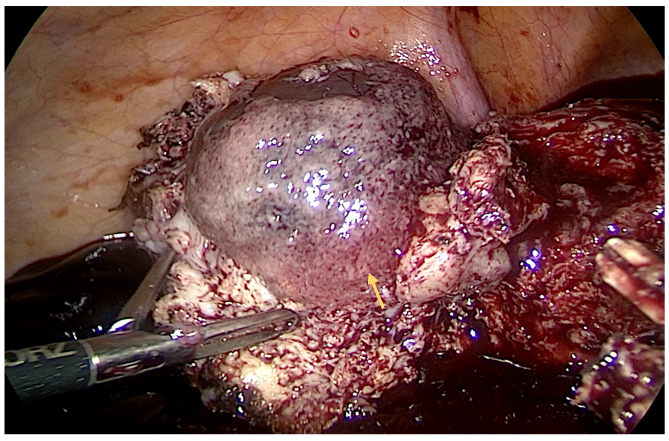 Diagnostics 14 00506 g001