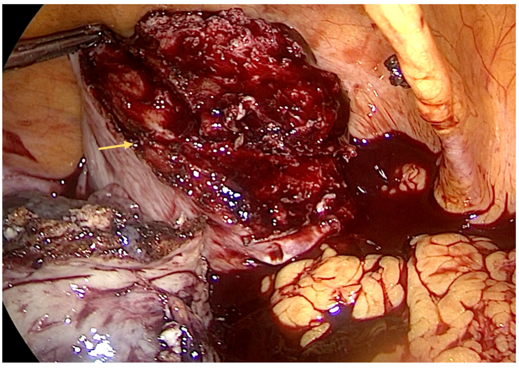 Diagnostics 14 00506 g002