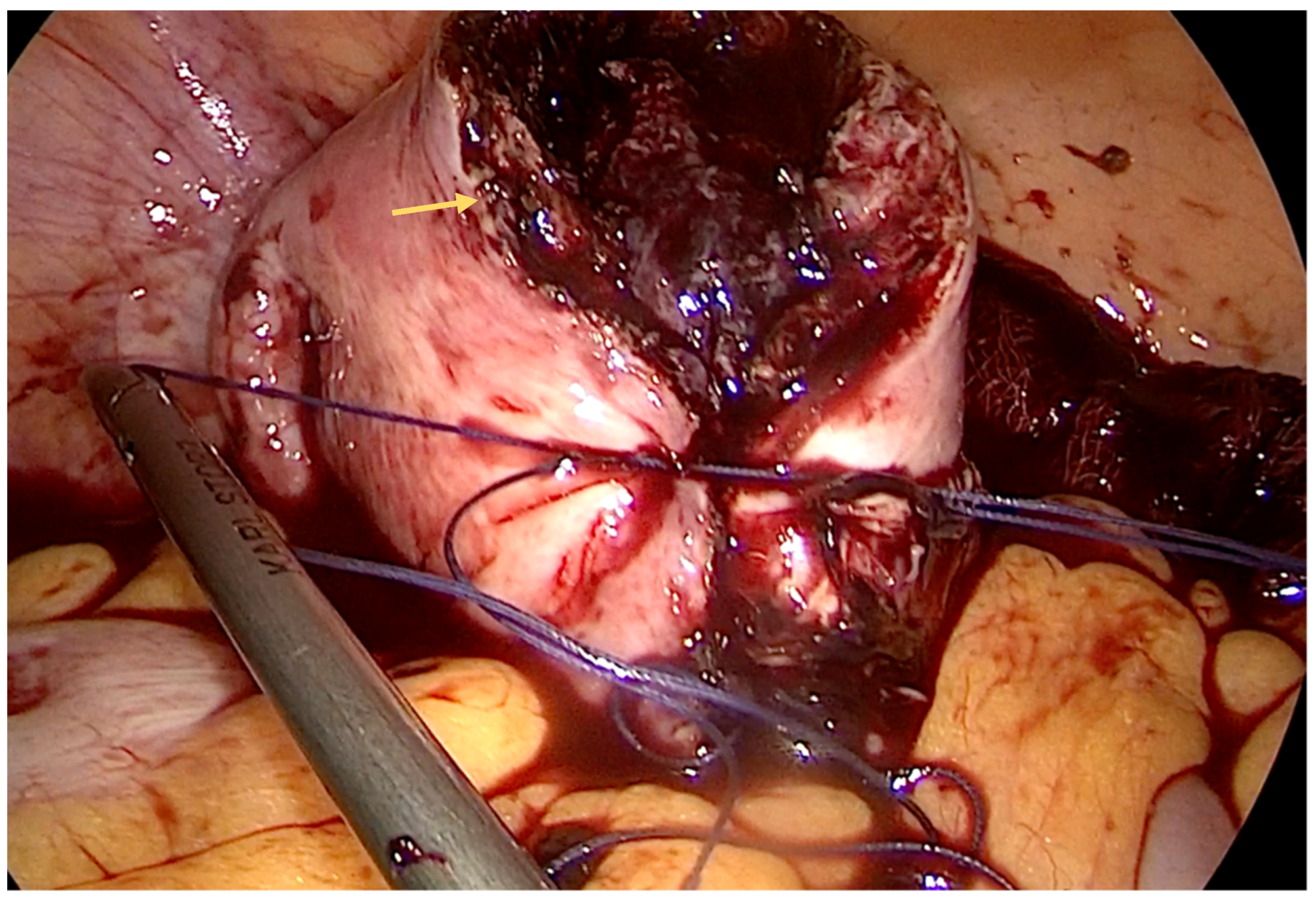 Diagnostics 14 00506 g003