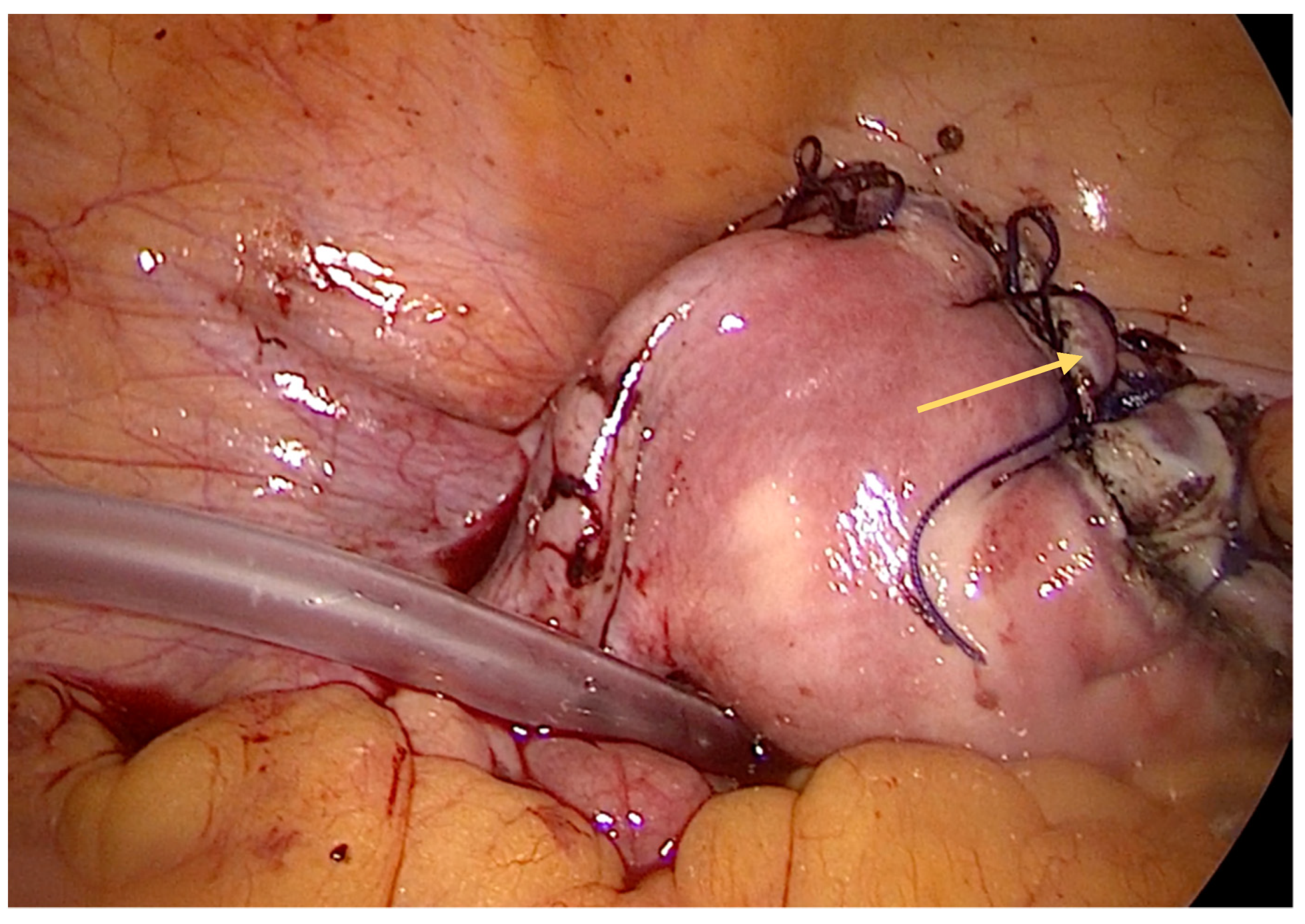 Diagnostics 14 00506 g004