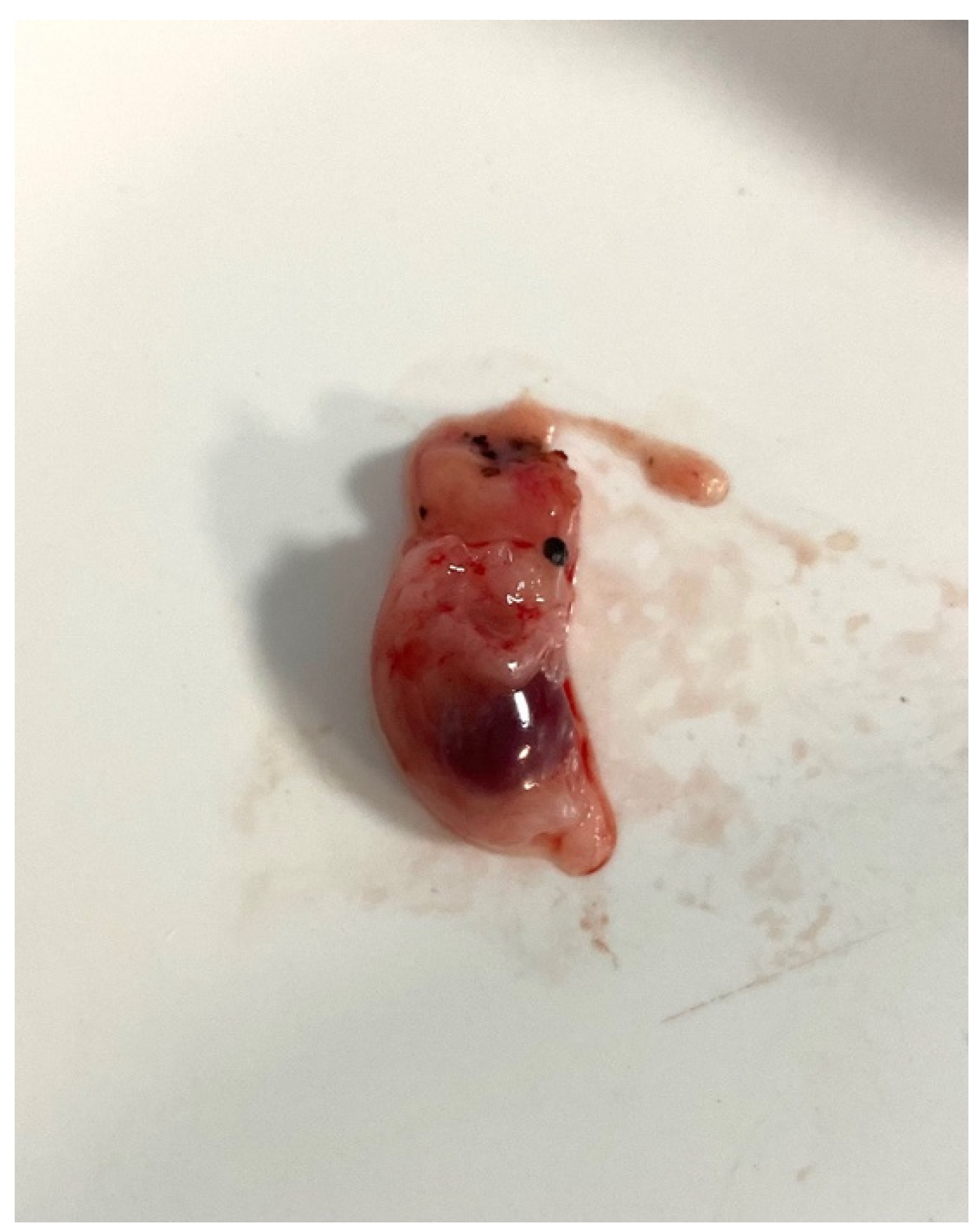 Diagnostics 14 00506 g005