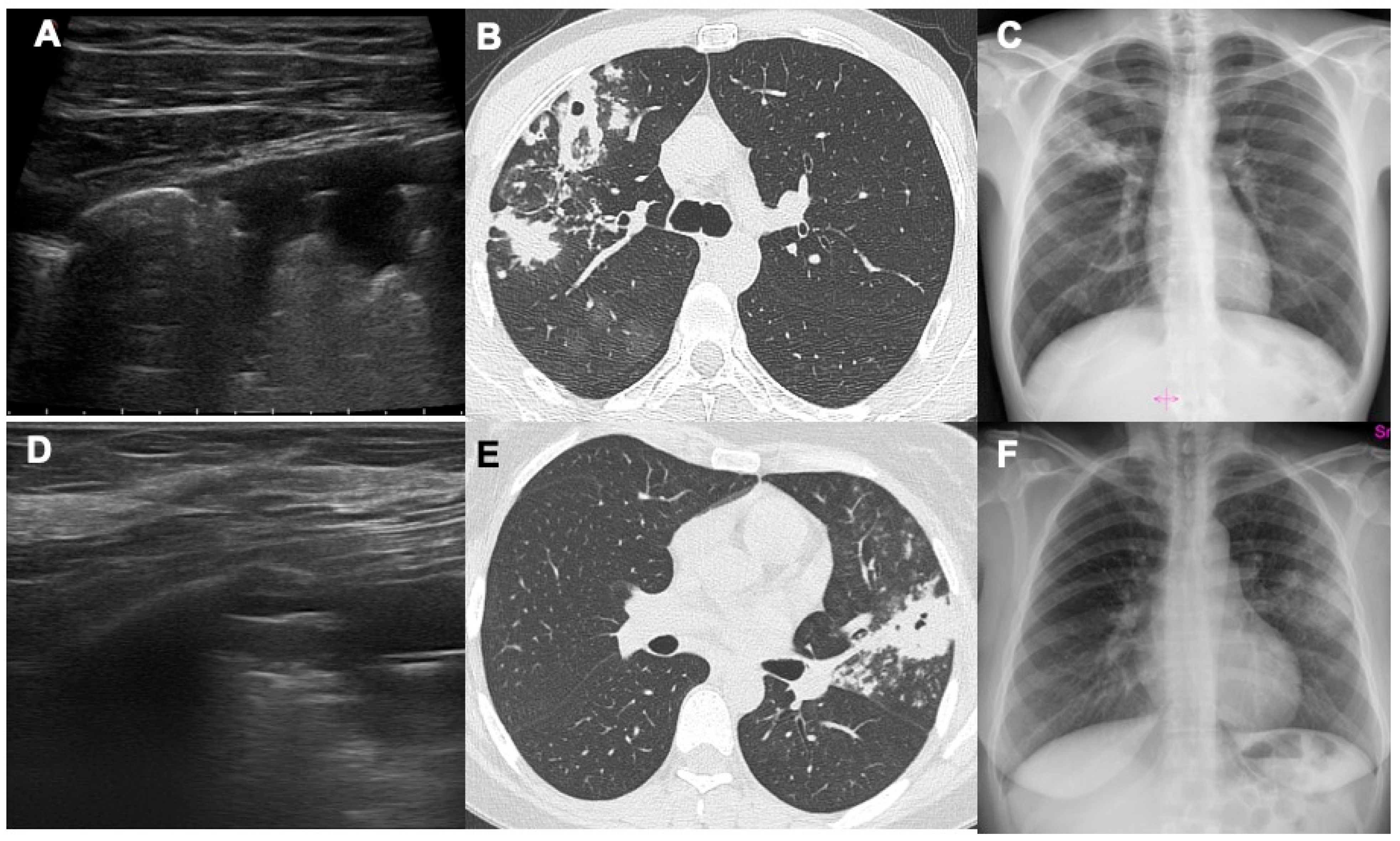 Diagnostics 14 00522 g001