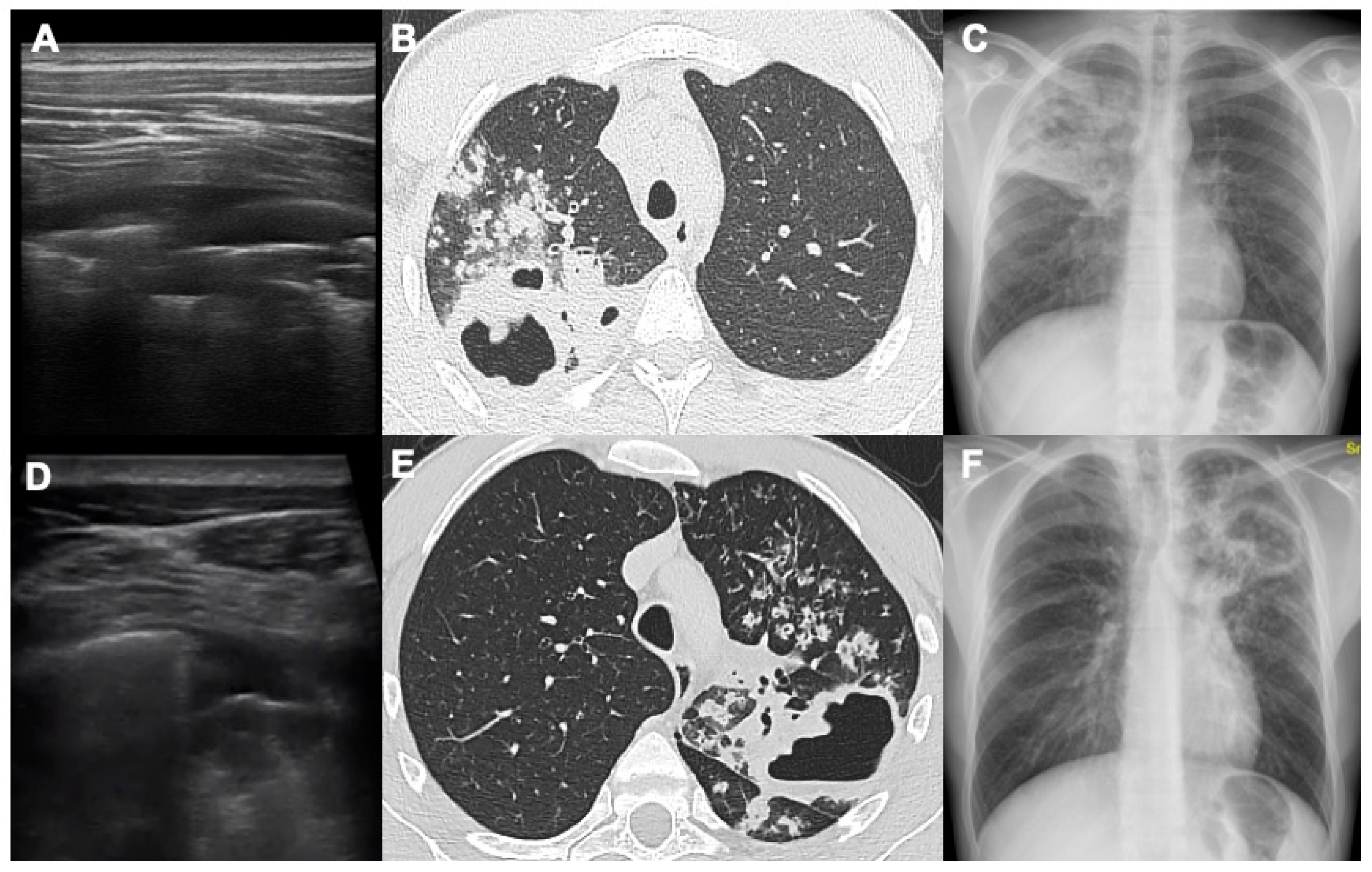 Diagnostics 14 00522 g002
