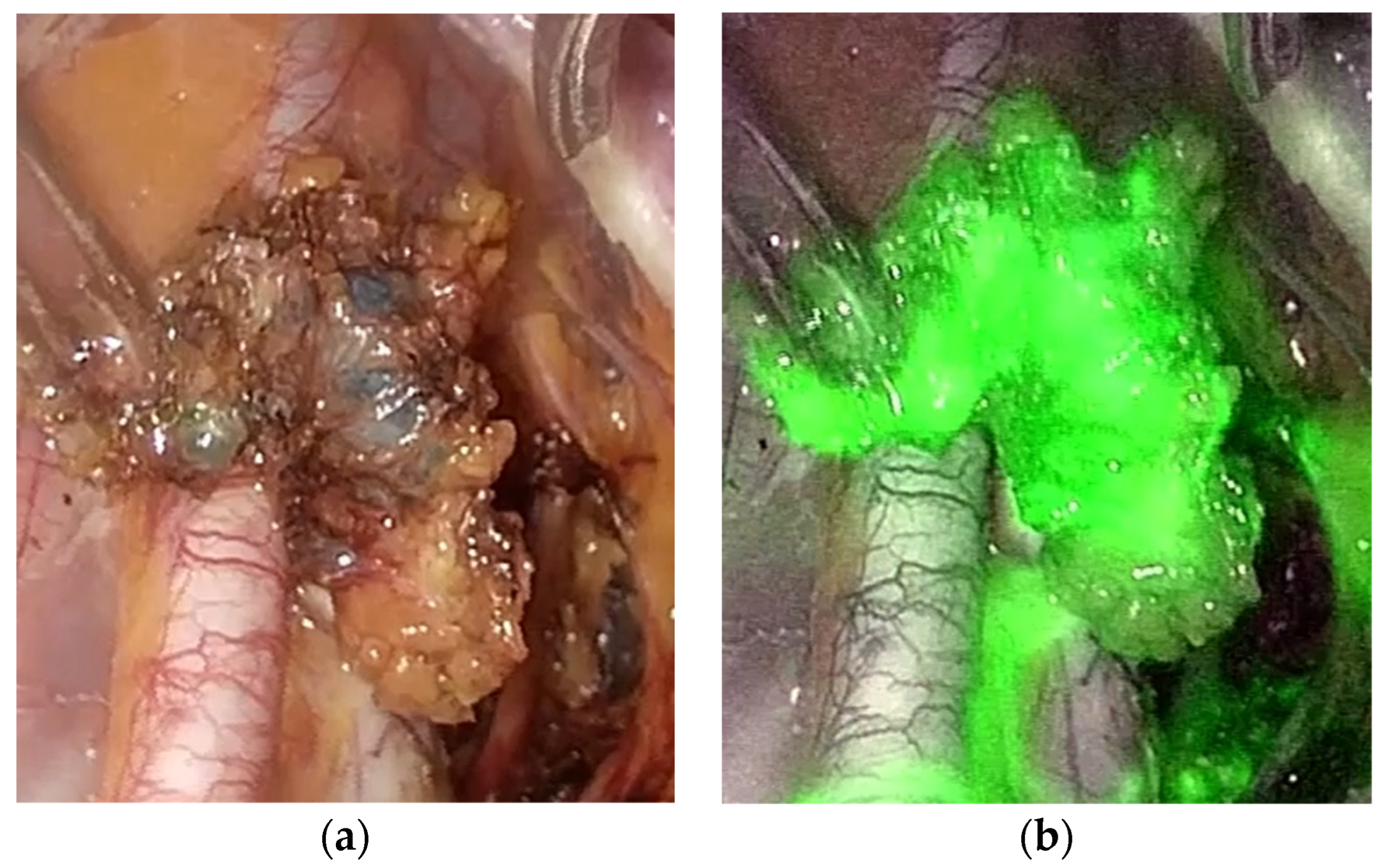 Diagnostics 14 00552 g001