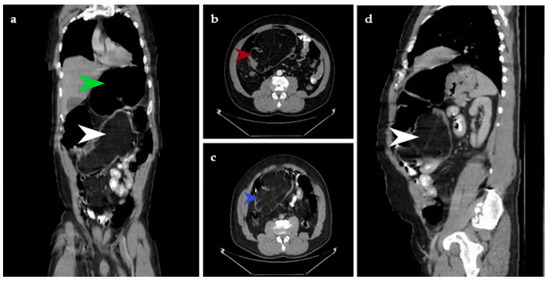 Diagnostics 14 00562 g001