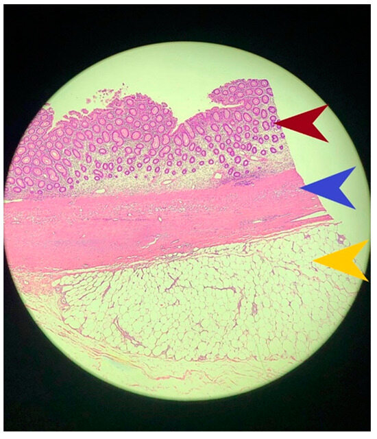 Diagnostics 14 00562 g003