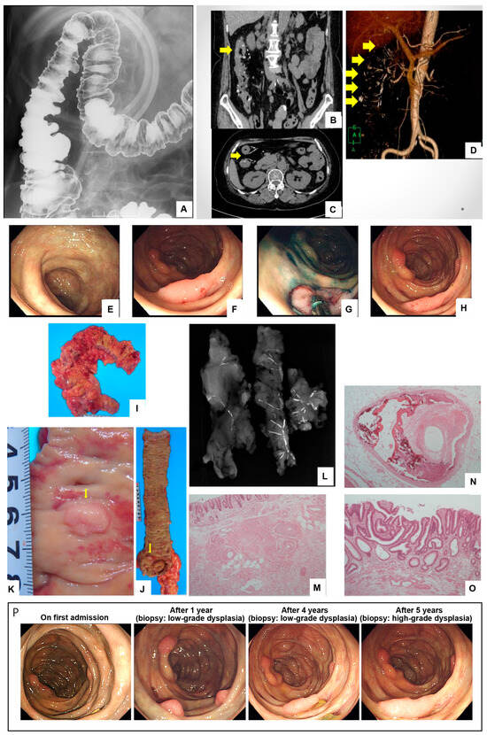 Diagnostics 14 00565 g001