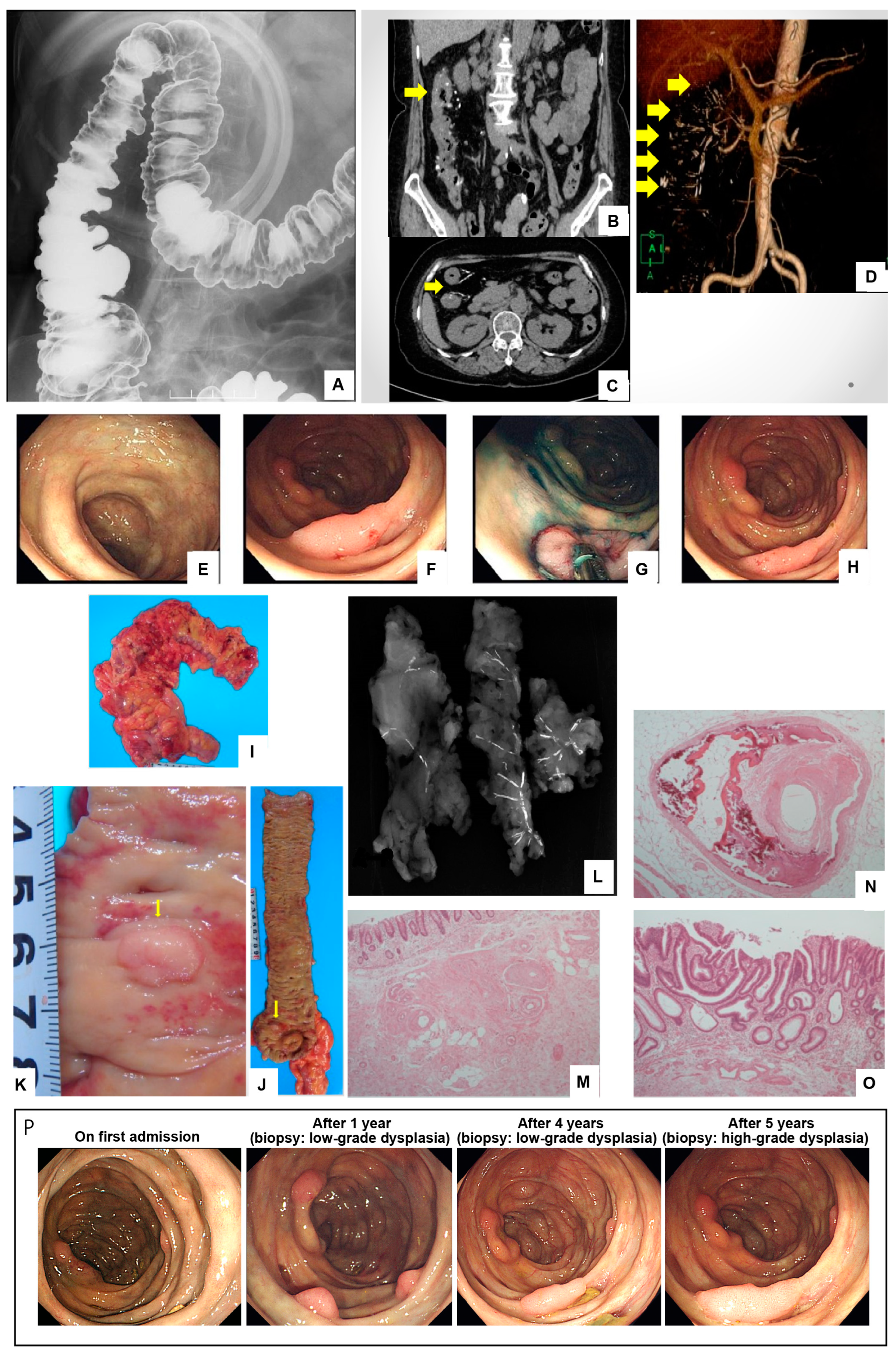 Diagnostics 14 00565 g001