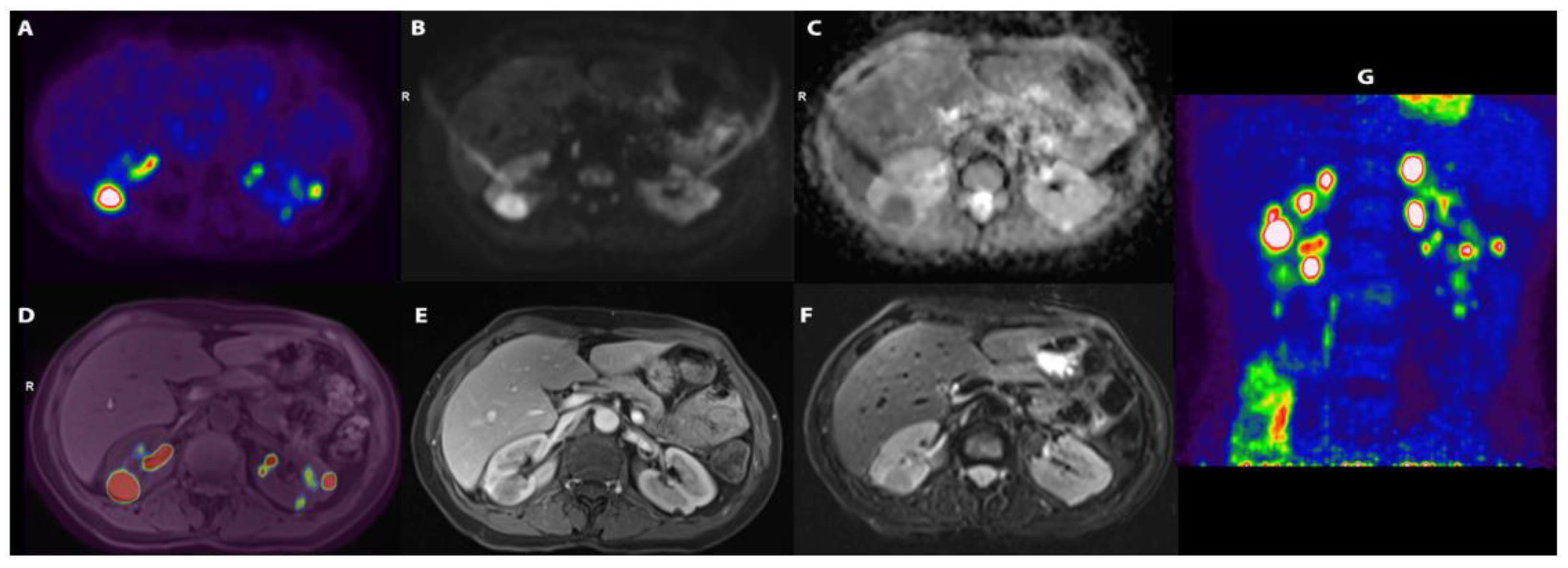 Diagnostics 14 00566 g001