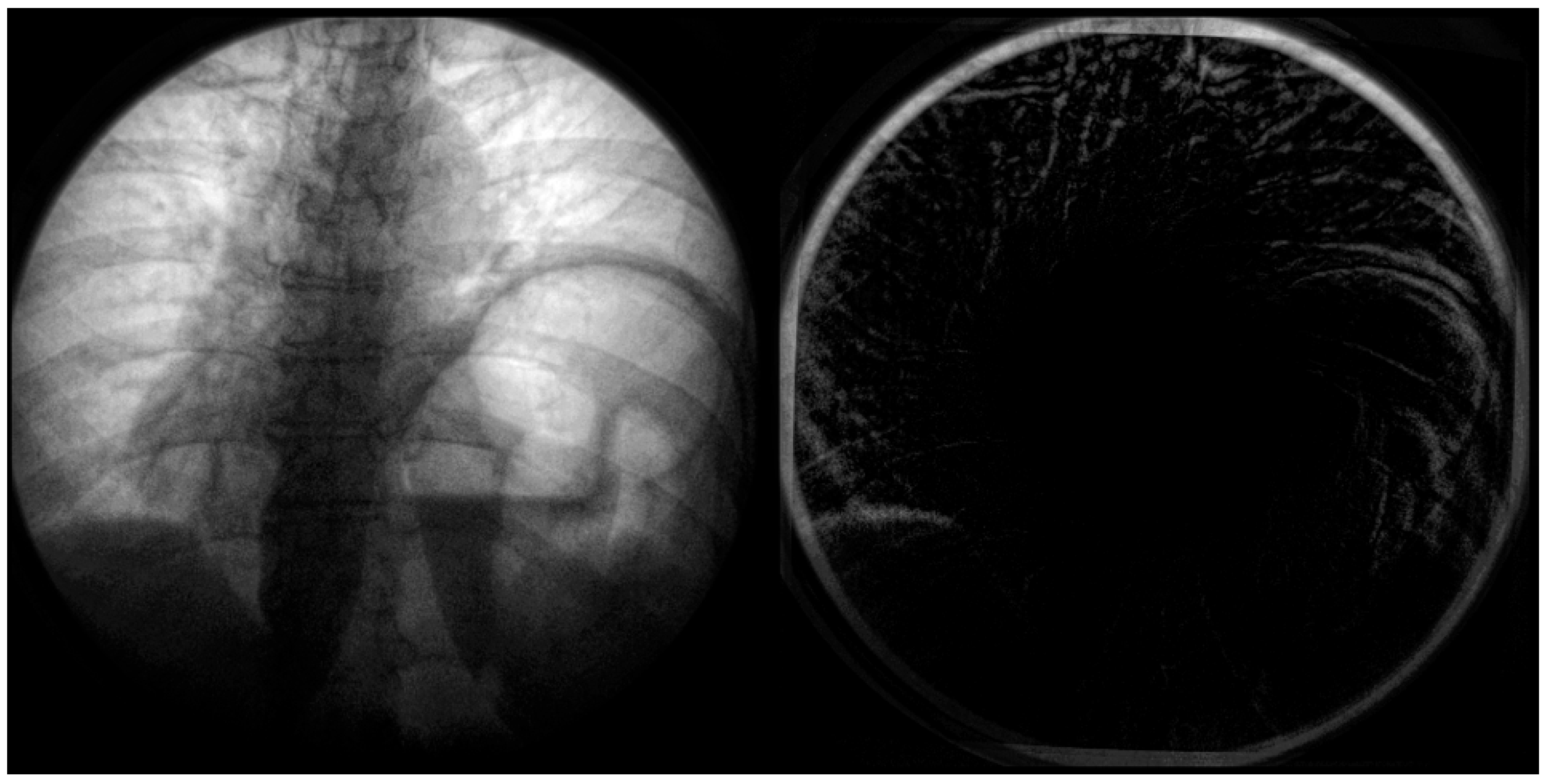 Diagnostics 14 00567 g006