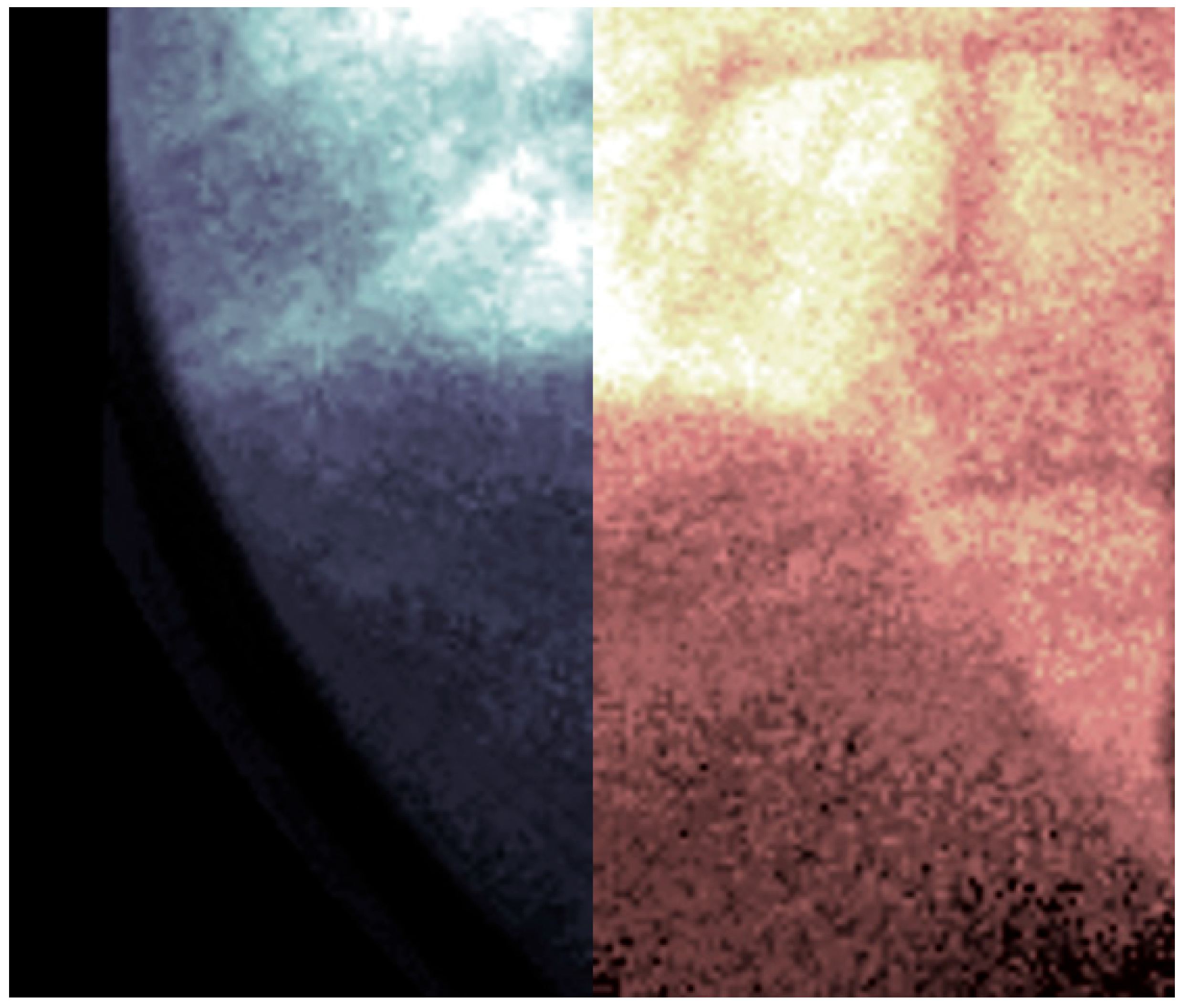 Diagnostics 14 00567 g007