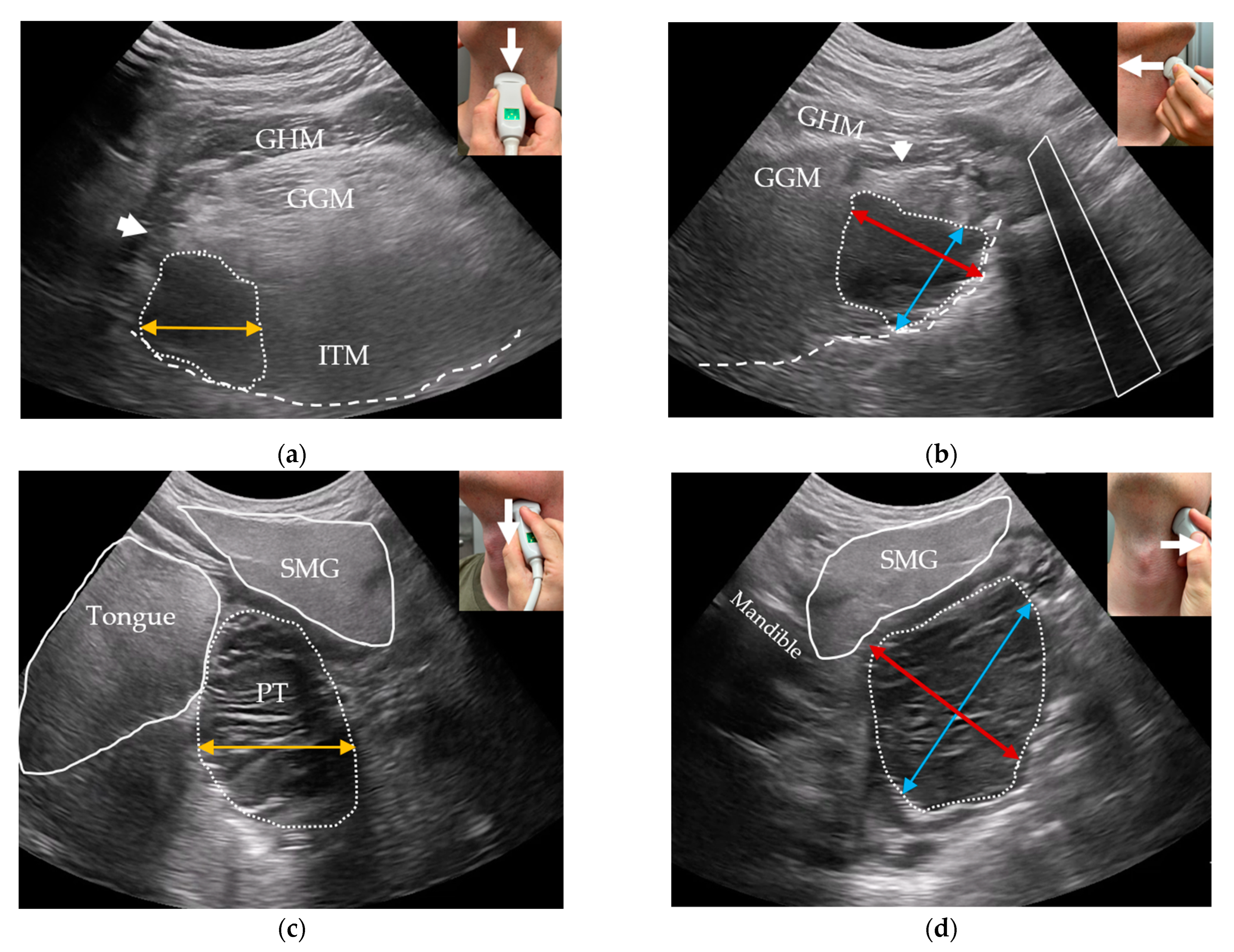 Diagnostics 14 00577 g003