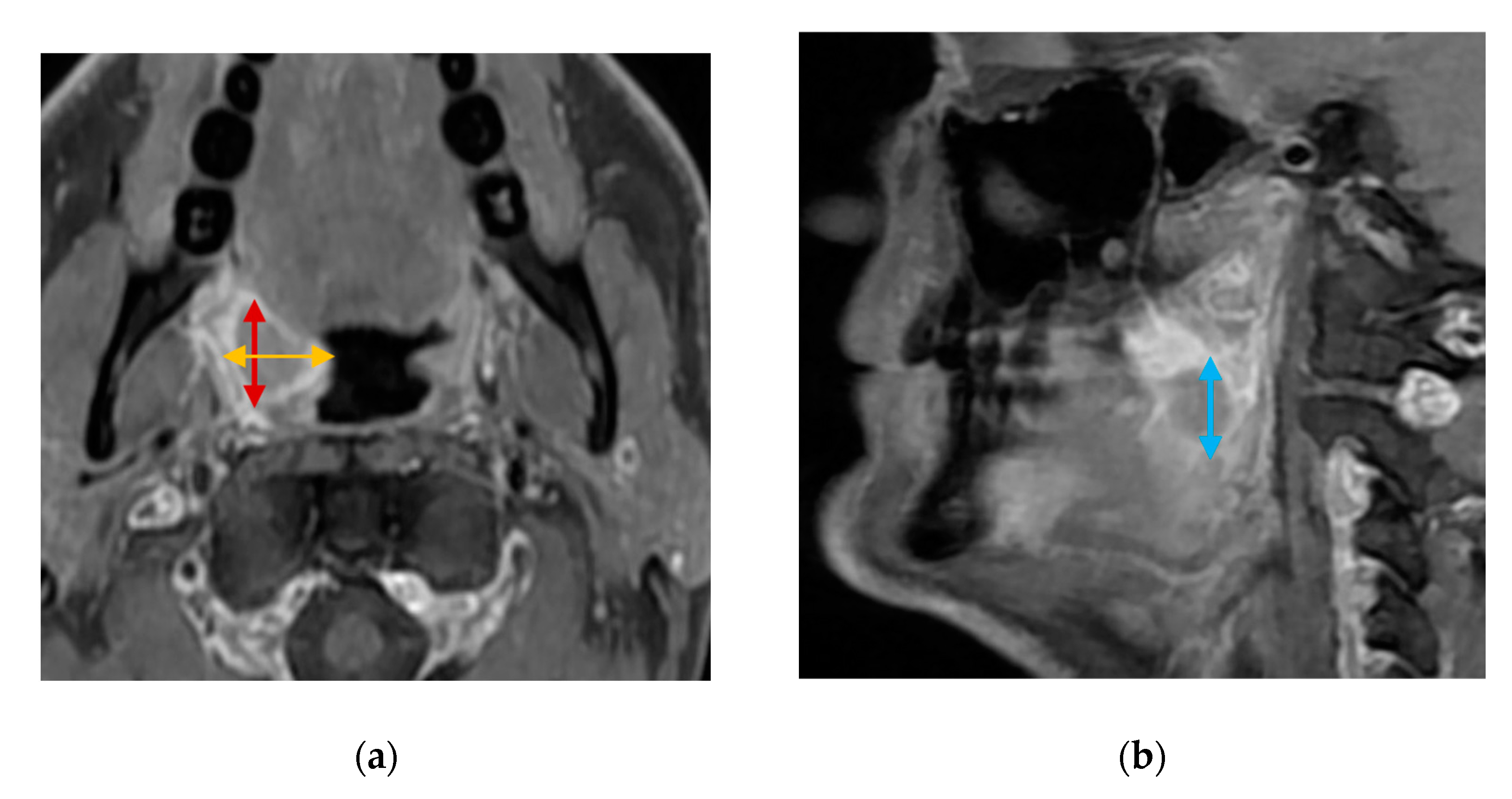 Diagnostics 14 00577 g004