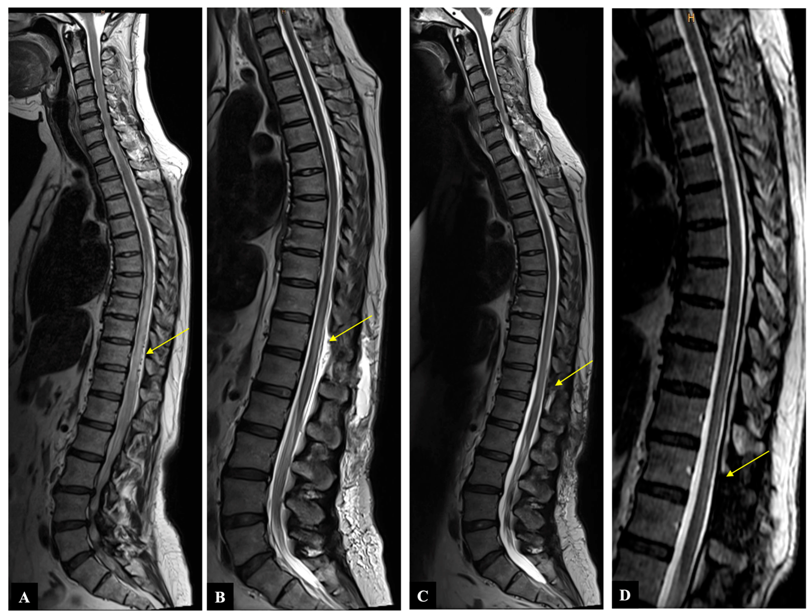 Diagnostics 14 00581 g002