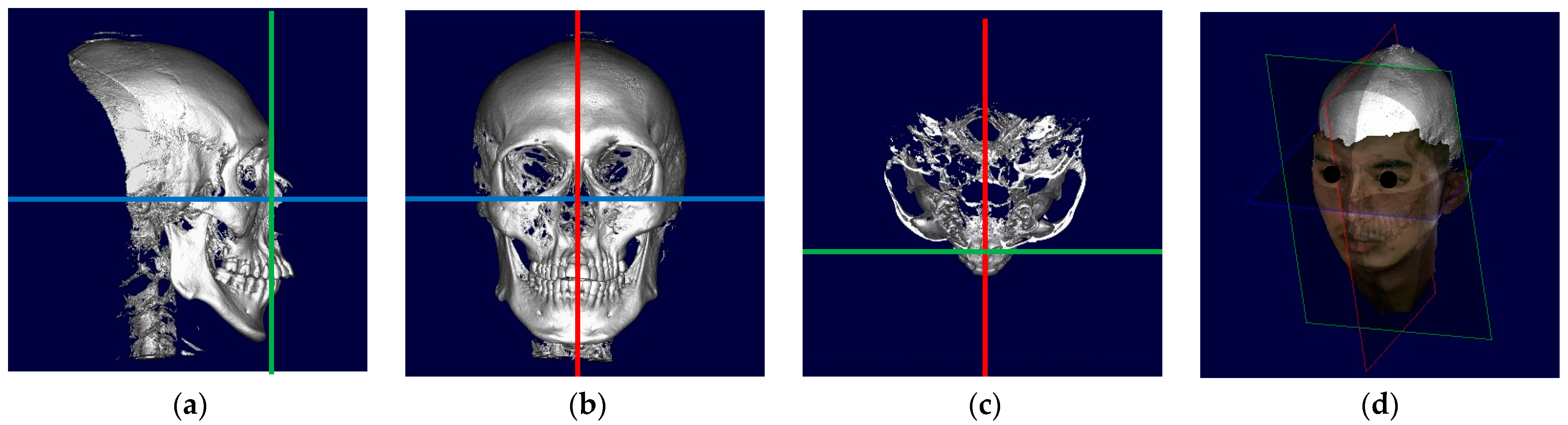 Diagnostics 14 00590 g001 Diagnostics 14 00590 g001