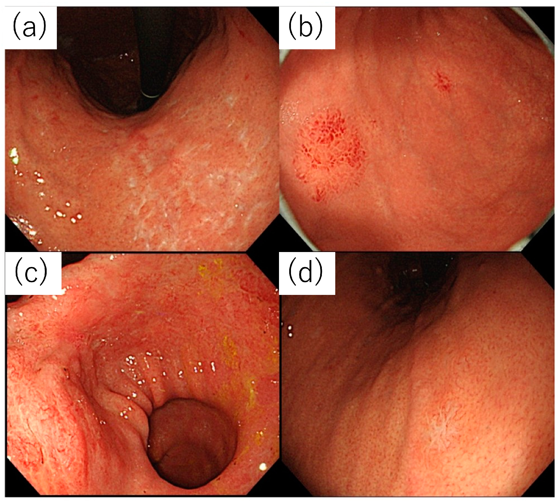 Diagnostics 14 00607 g002
