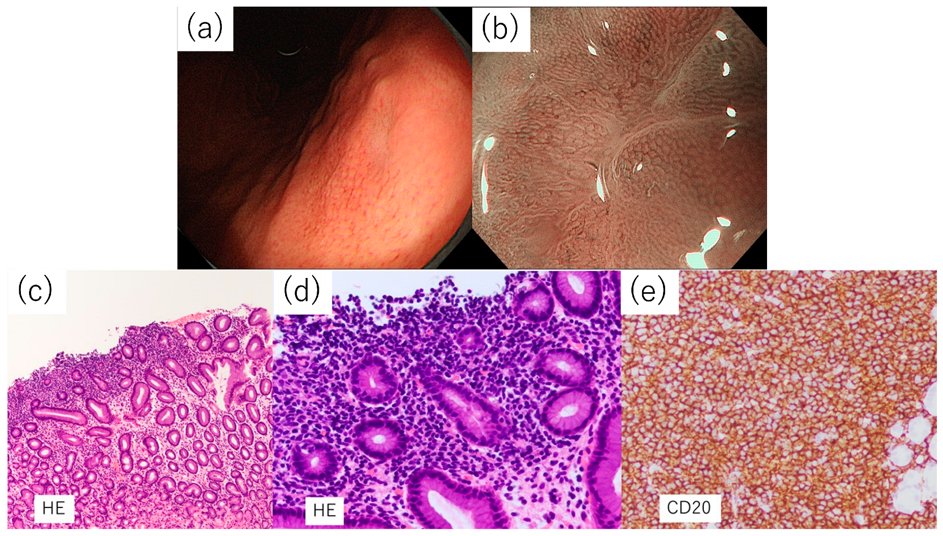 Diagnostics 14 00607 g005