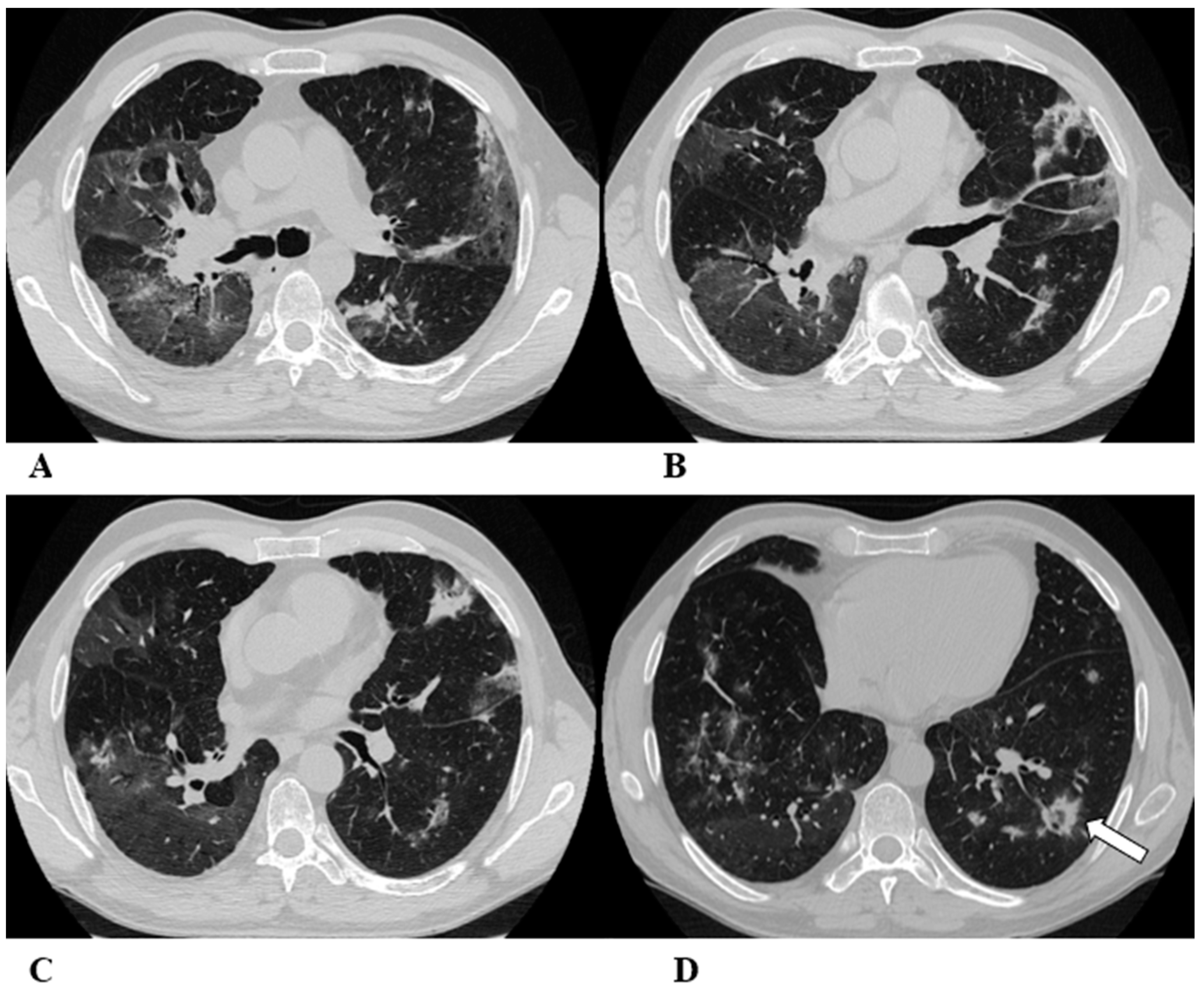 Diagnostics 14 00613 g001