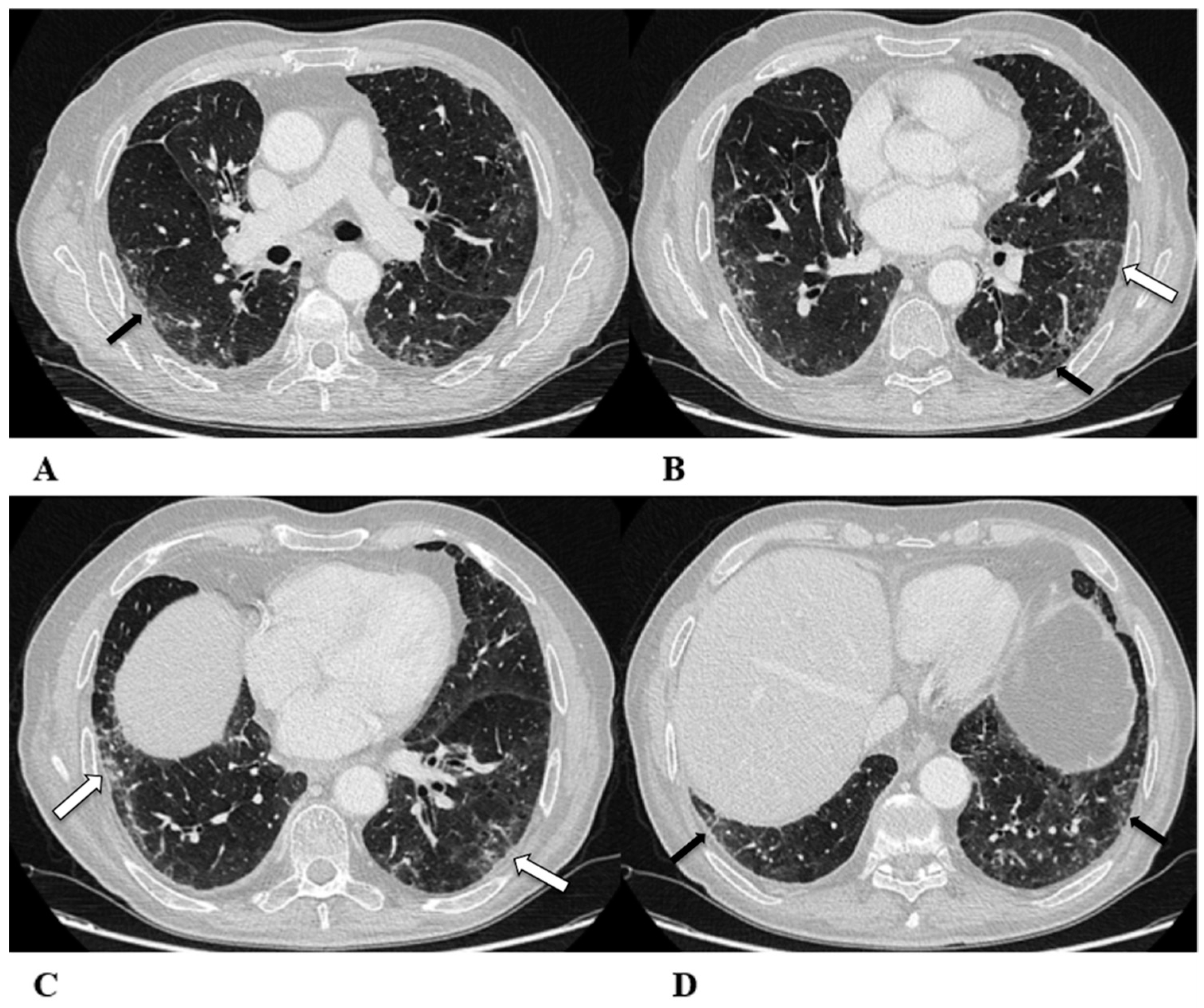 Diagnostics 14 00613 g002