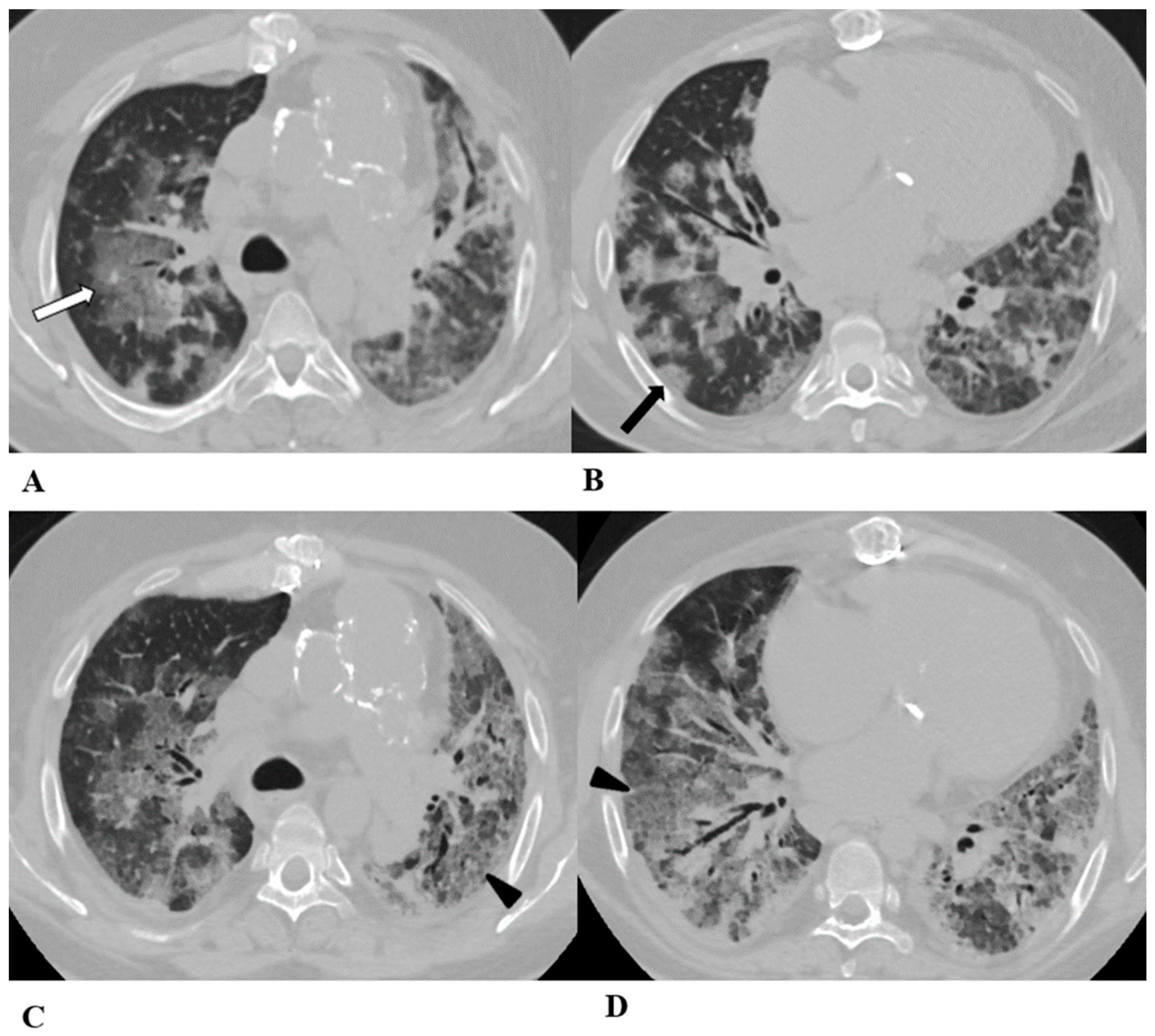 Diagnostics 14 00613 g004
