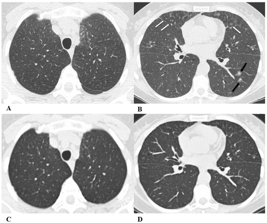 Diagnostics 14 00613 g005