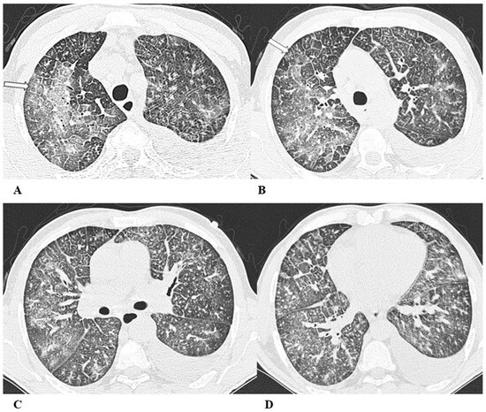 Diagnostics 14 00613 g006