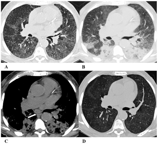 Diagnostics 14 00613 g007