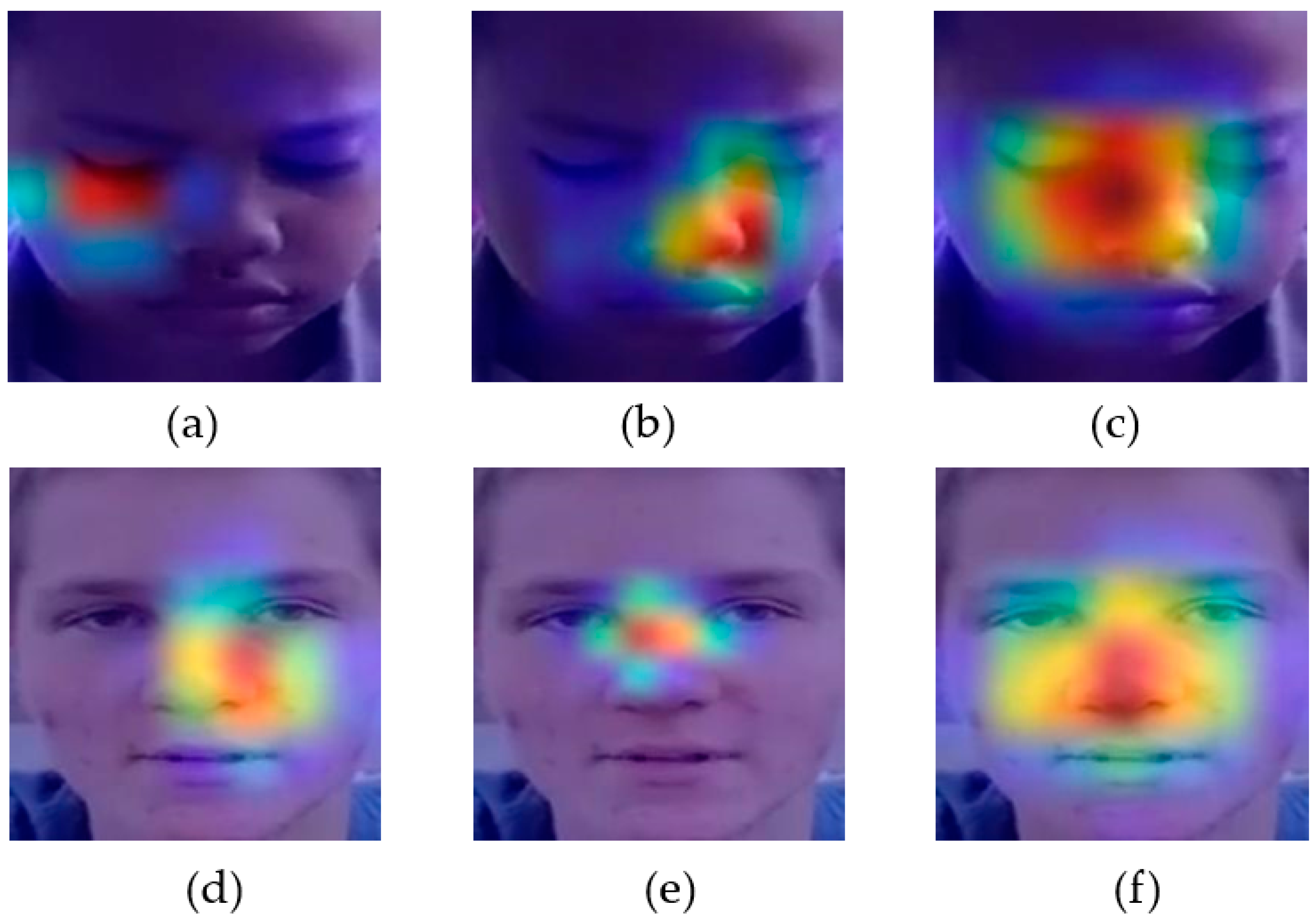 Diagnostics 14 00629 g007