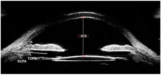 Diagnostics 14 00639 g001