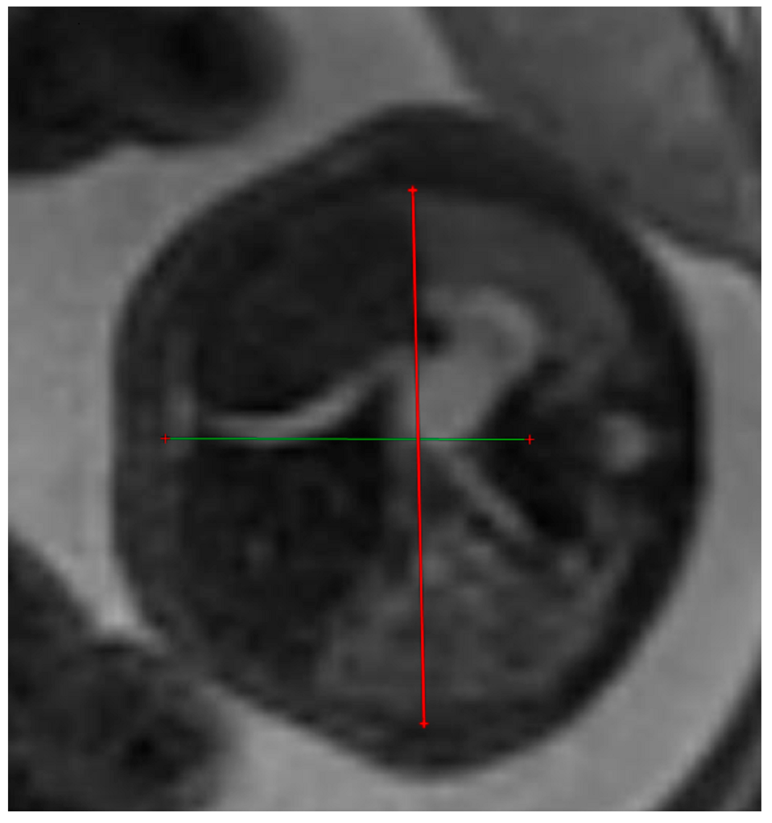 Diagnostics 14 00641 g003
