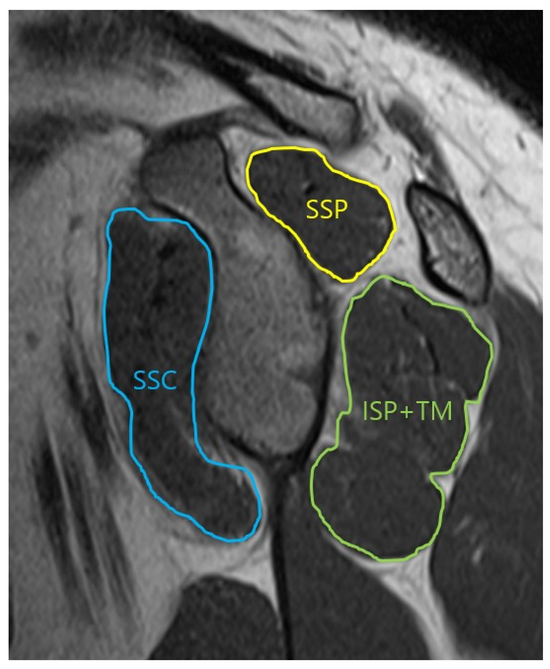 Diagnostics 14 00648 g002