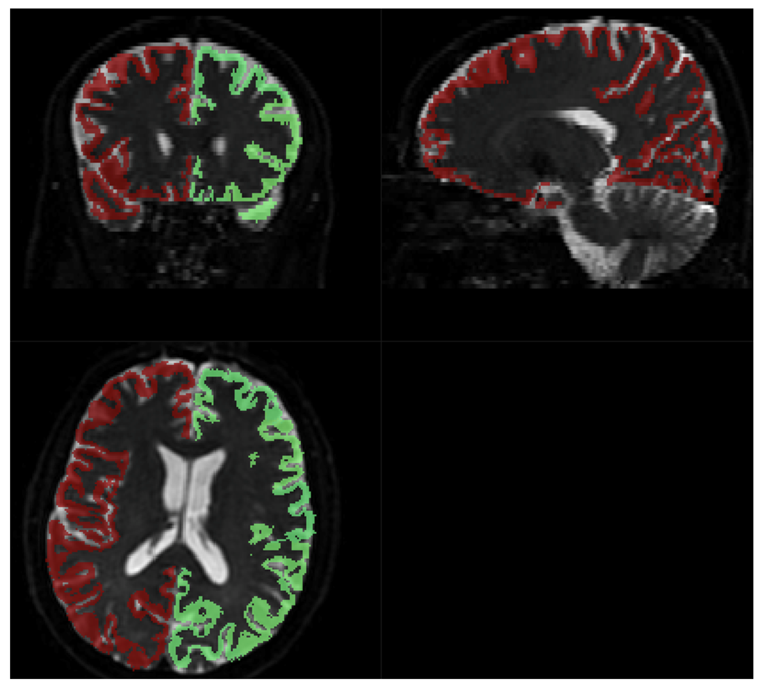 Diagnostics 14 00653 g008
