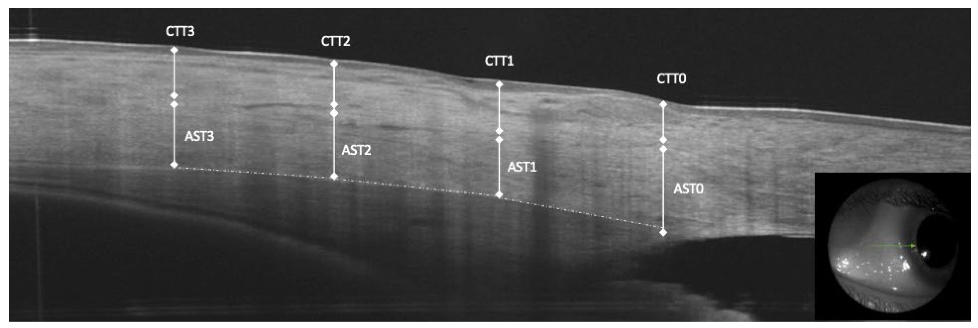 Diagnostics 14 00655 g001