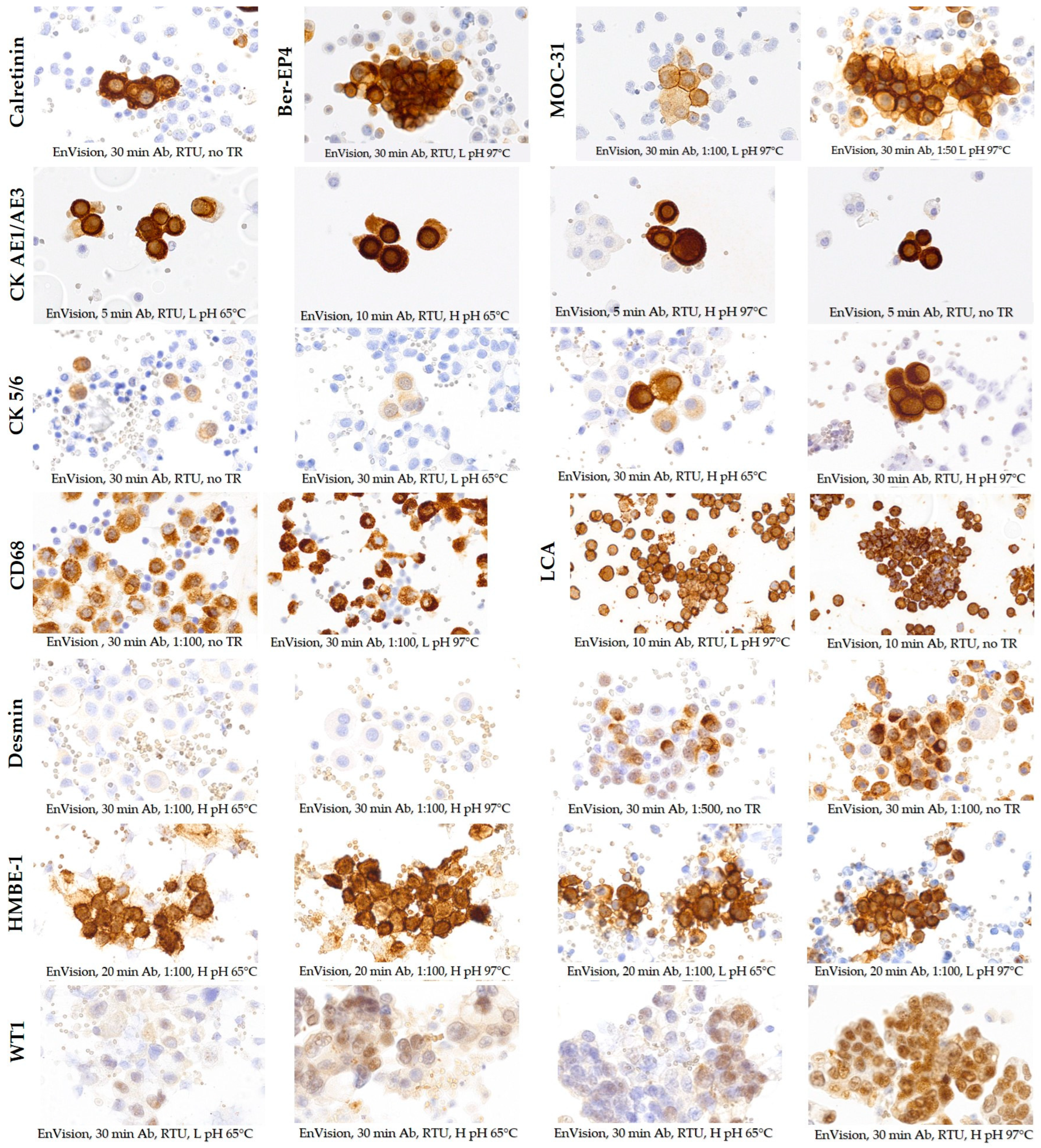 Diagnostics 14 00657 g004