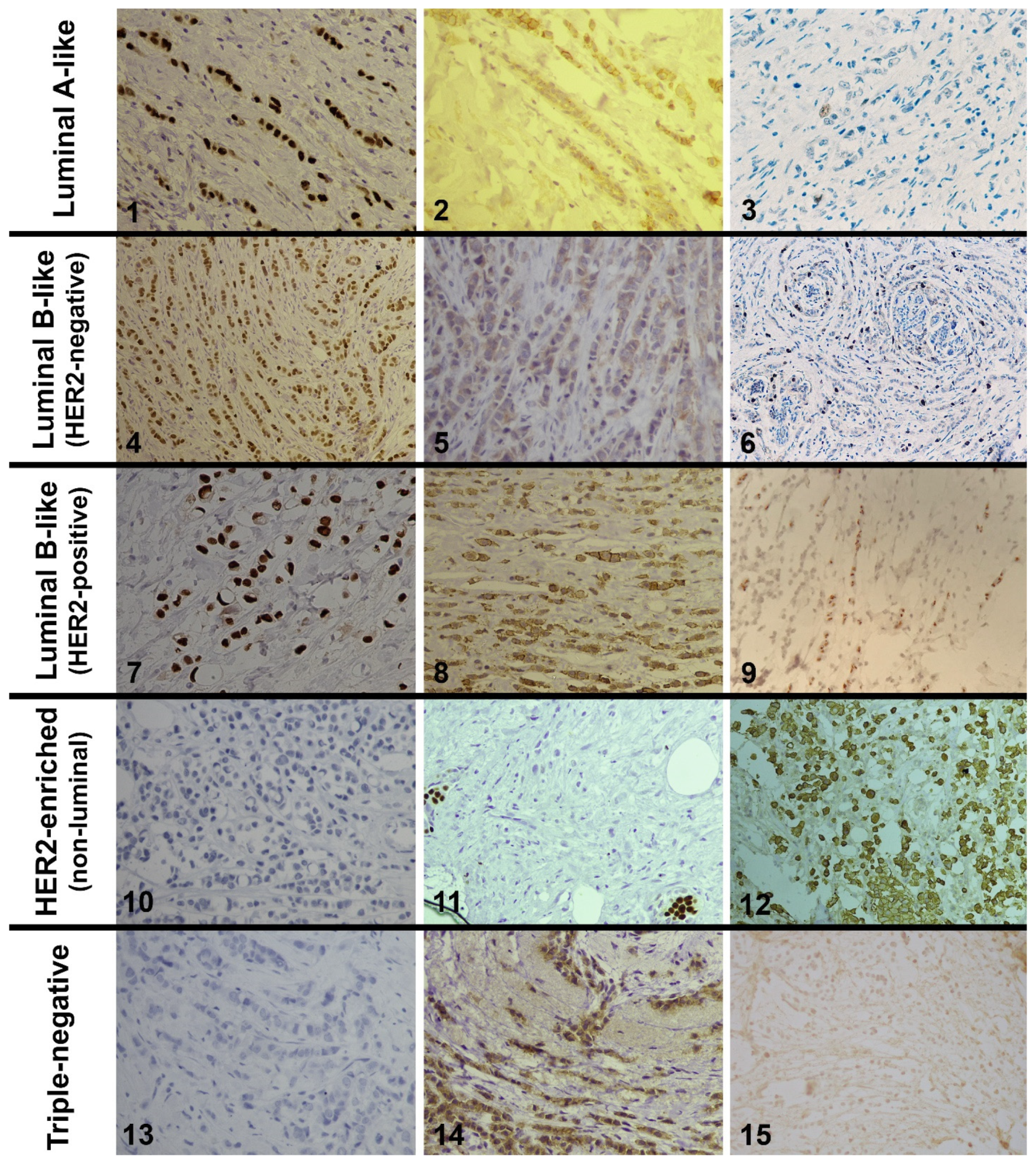 Diagnostics 14 00660 g001