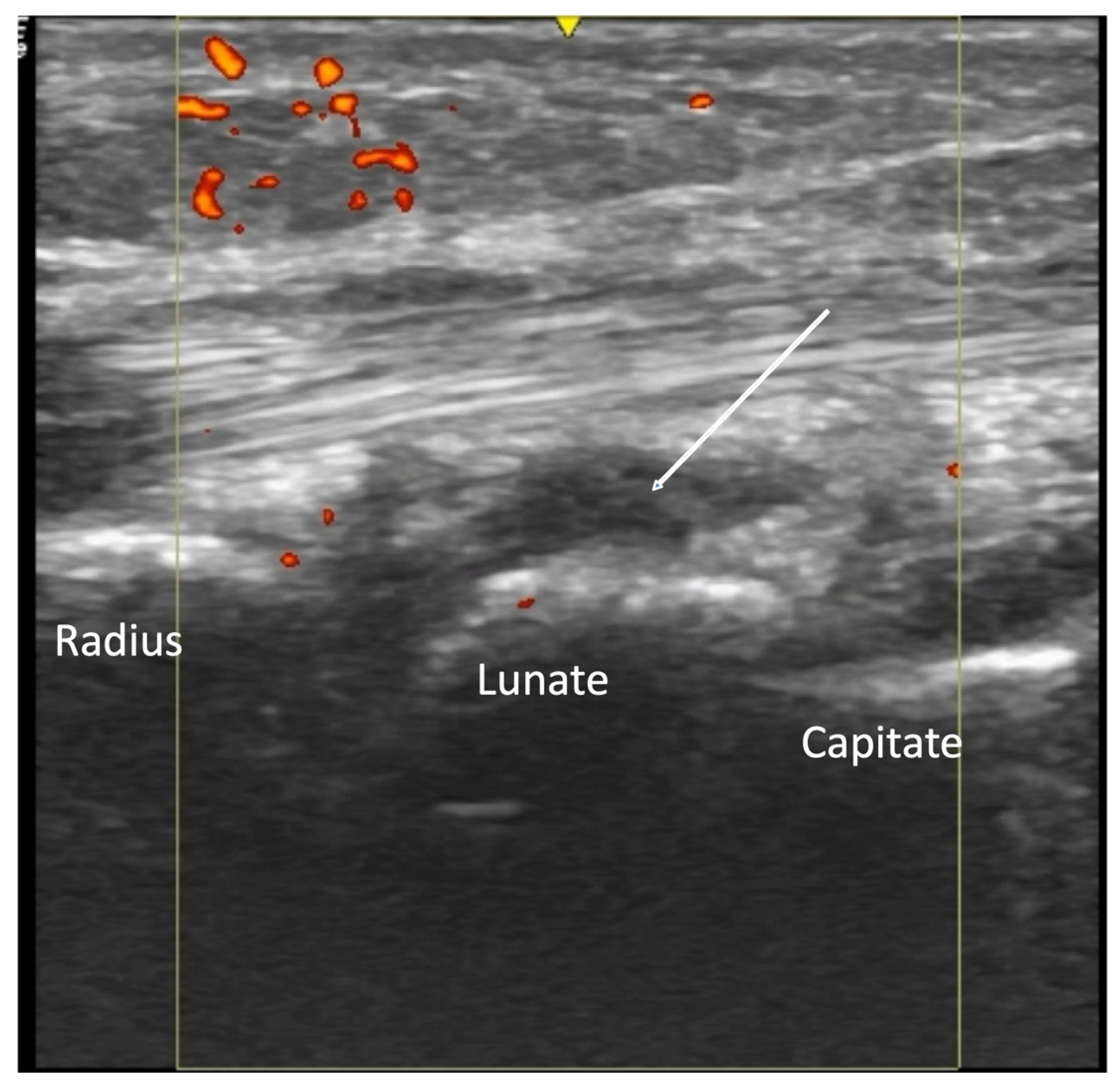 Diagnostics 14 00669 g005
