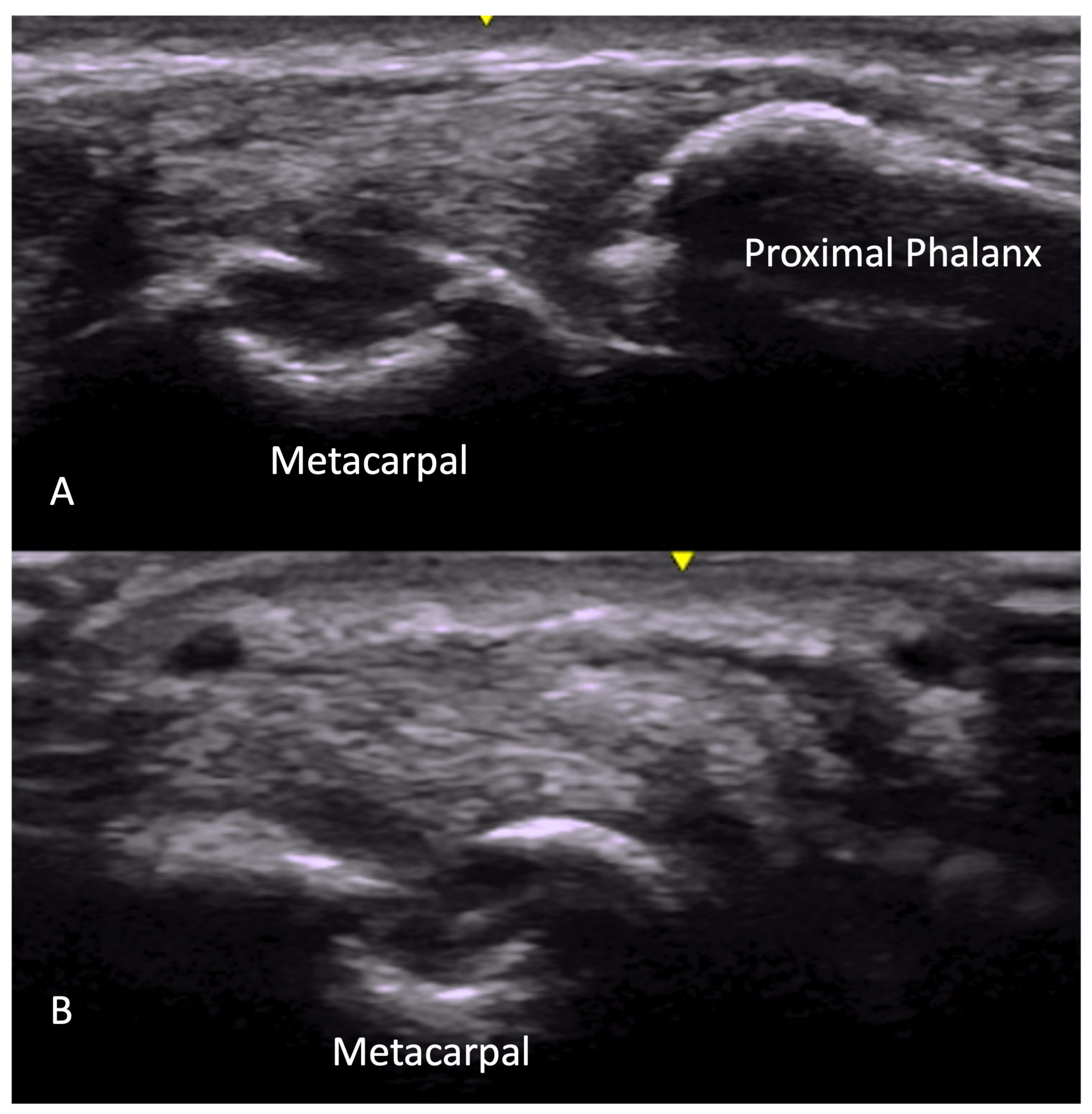 Diagnostics 14 00669 g006