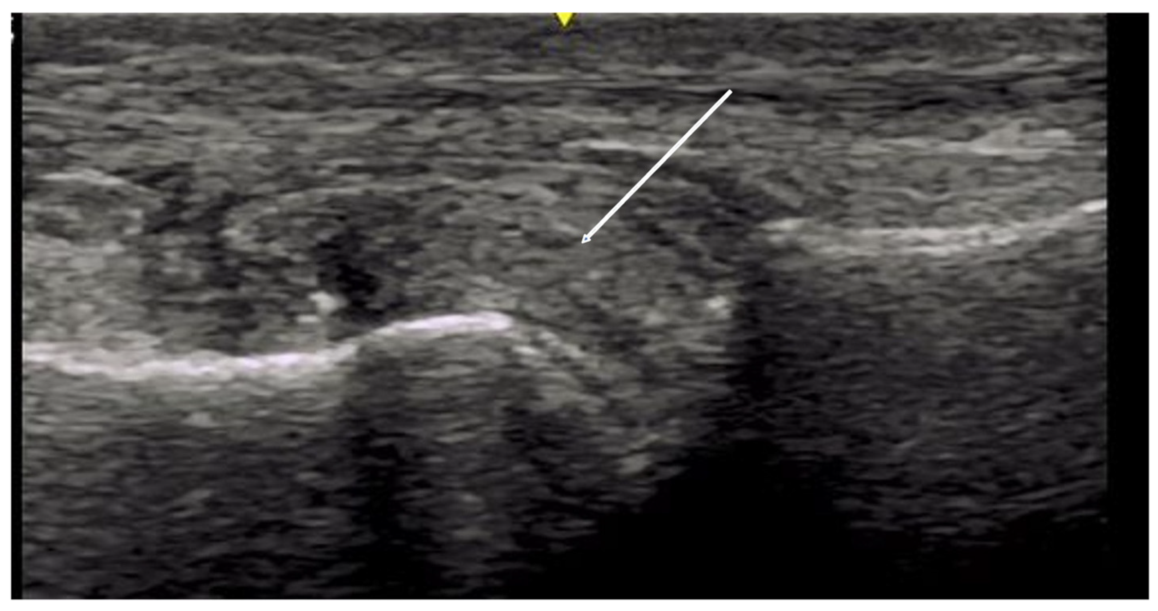 Diagnostics 14 00669 g007