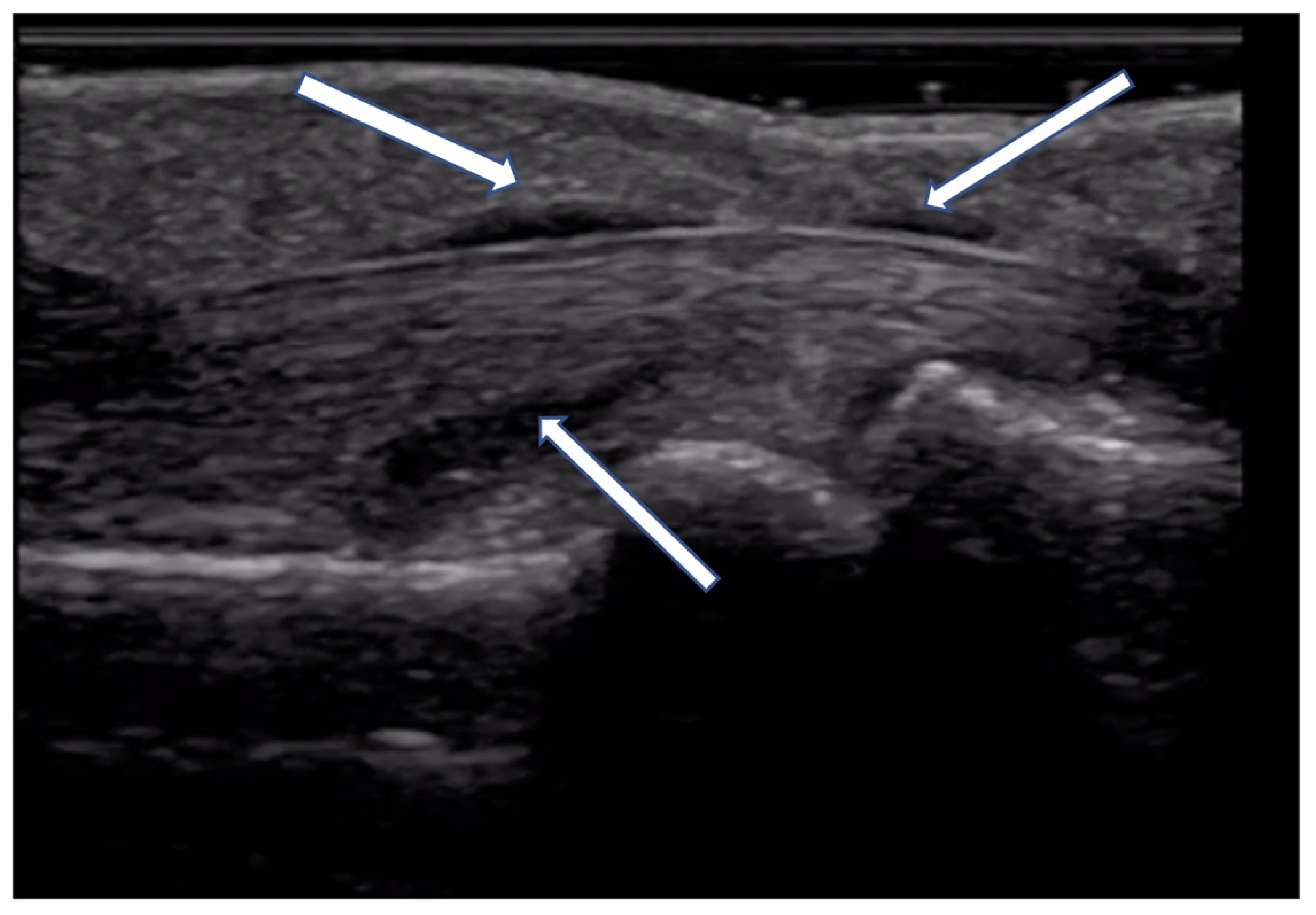 Diagnostics 14 00669 g013