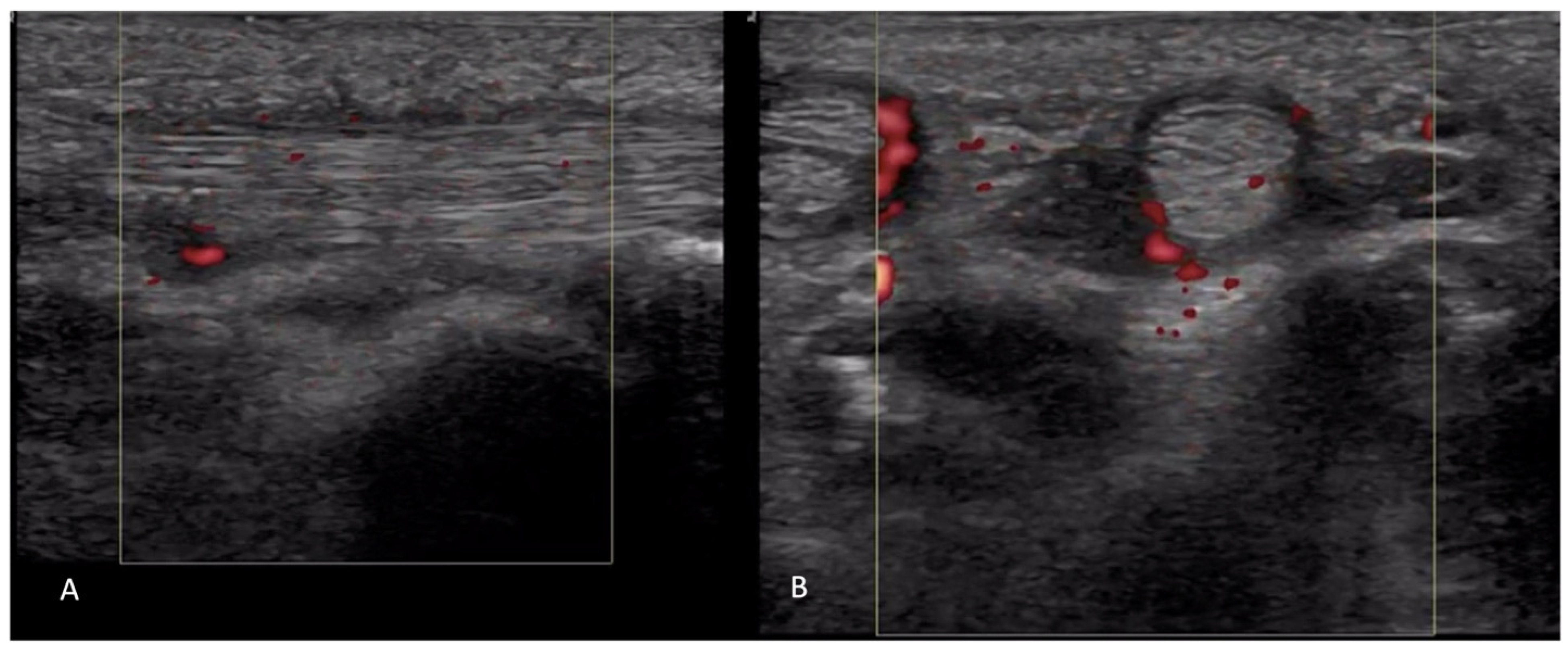 Diagnostics 14 00669 g014