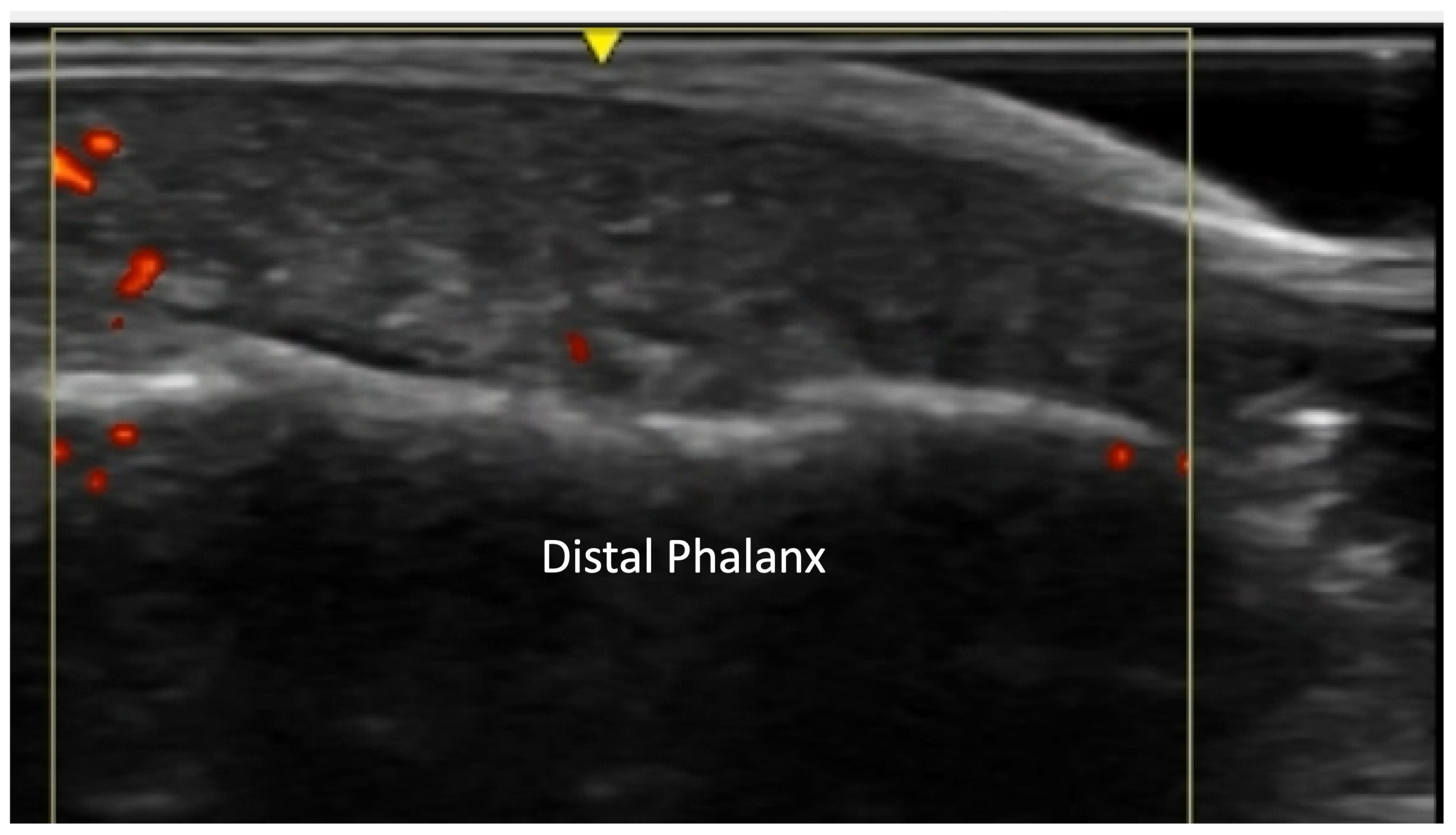 Diagnostics 14 00669 g017