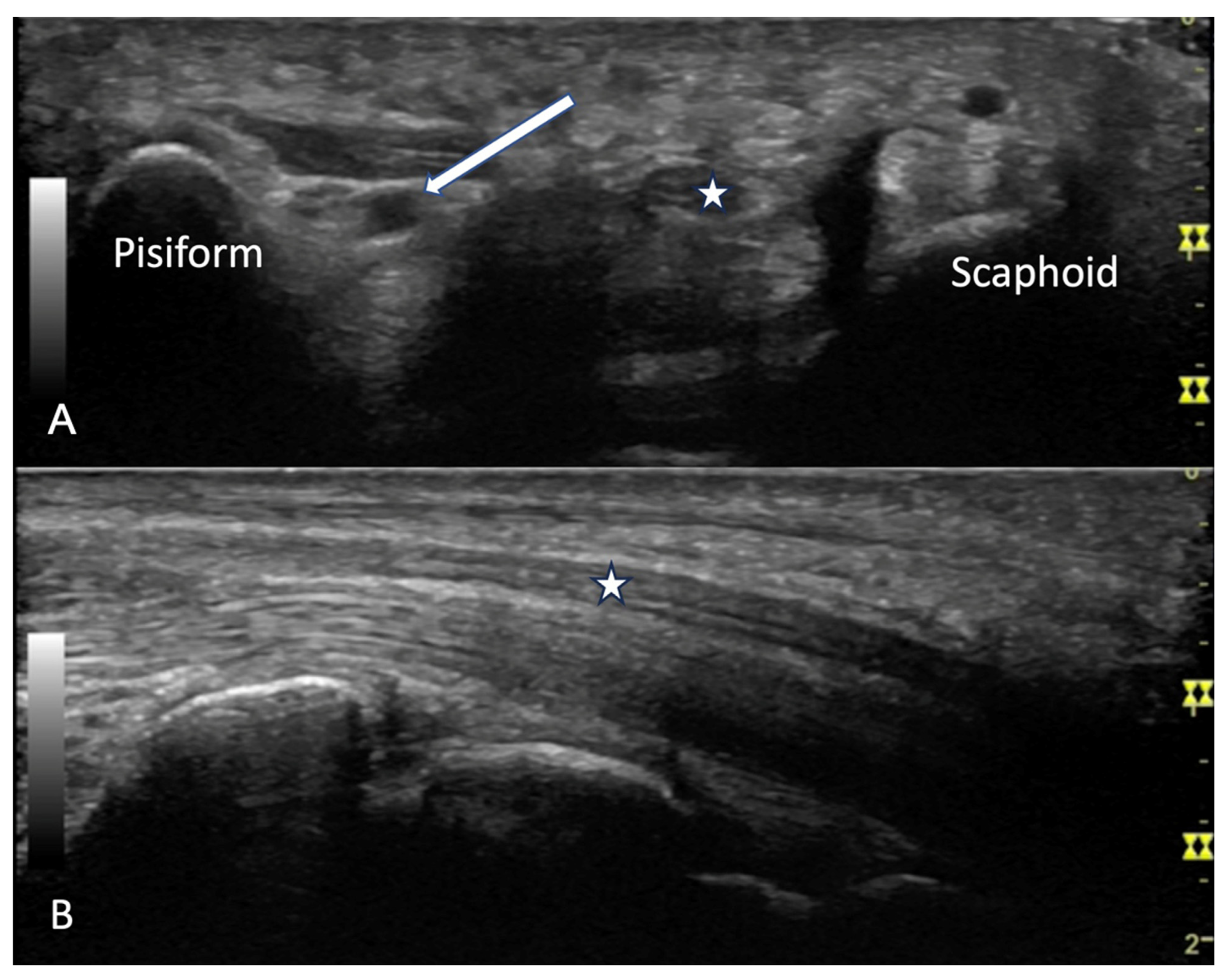Diagnostics 14 00669 g023