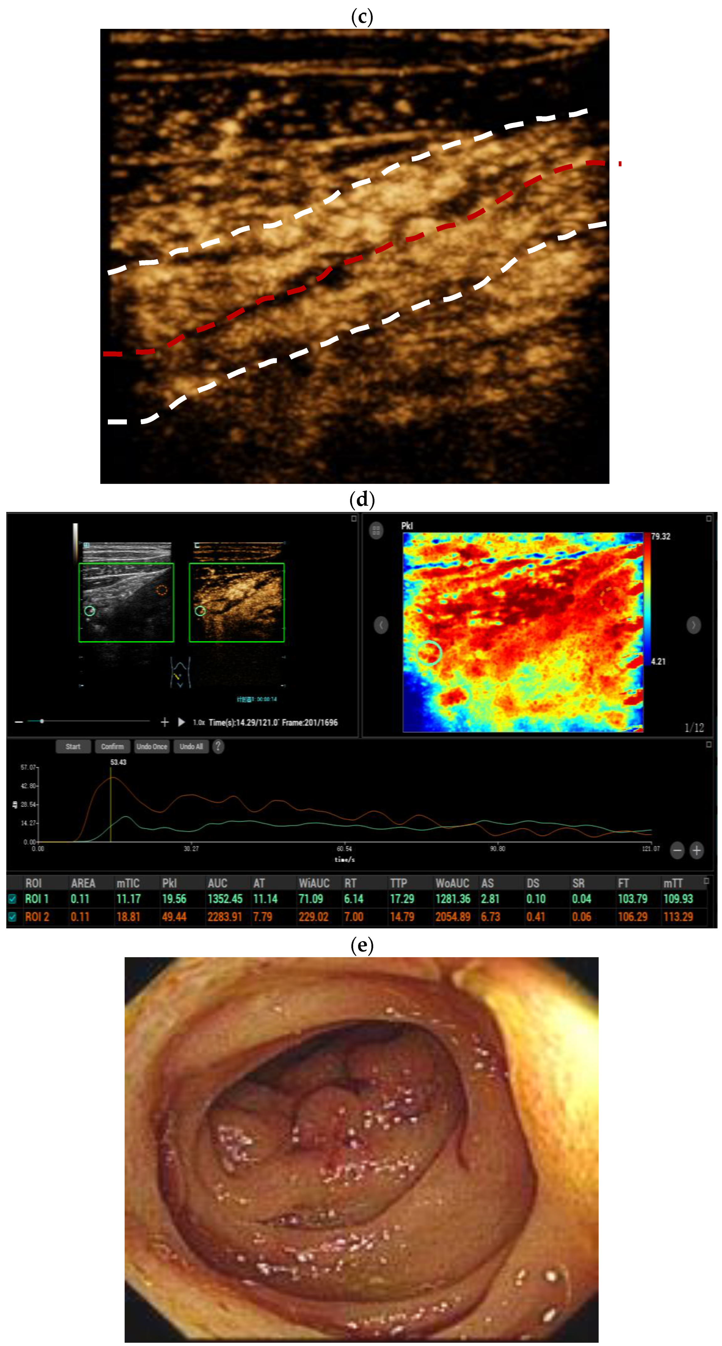 Diagnostics 14 00672 g002b