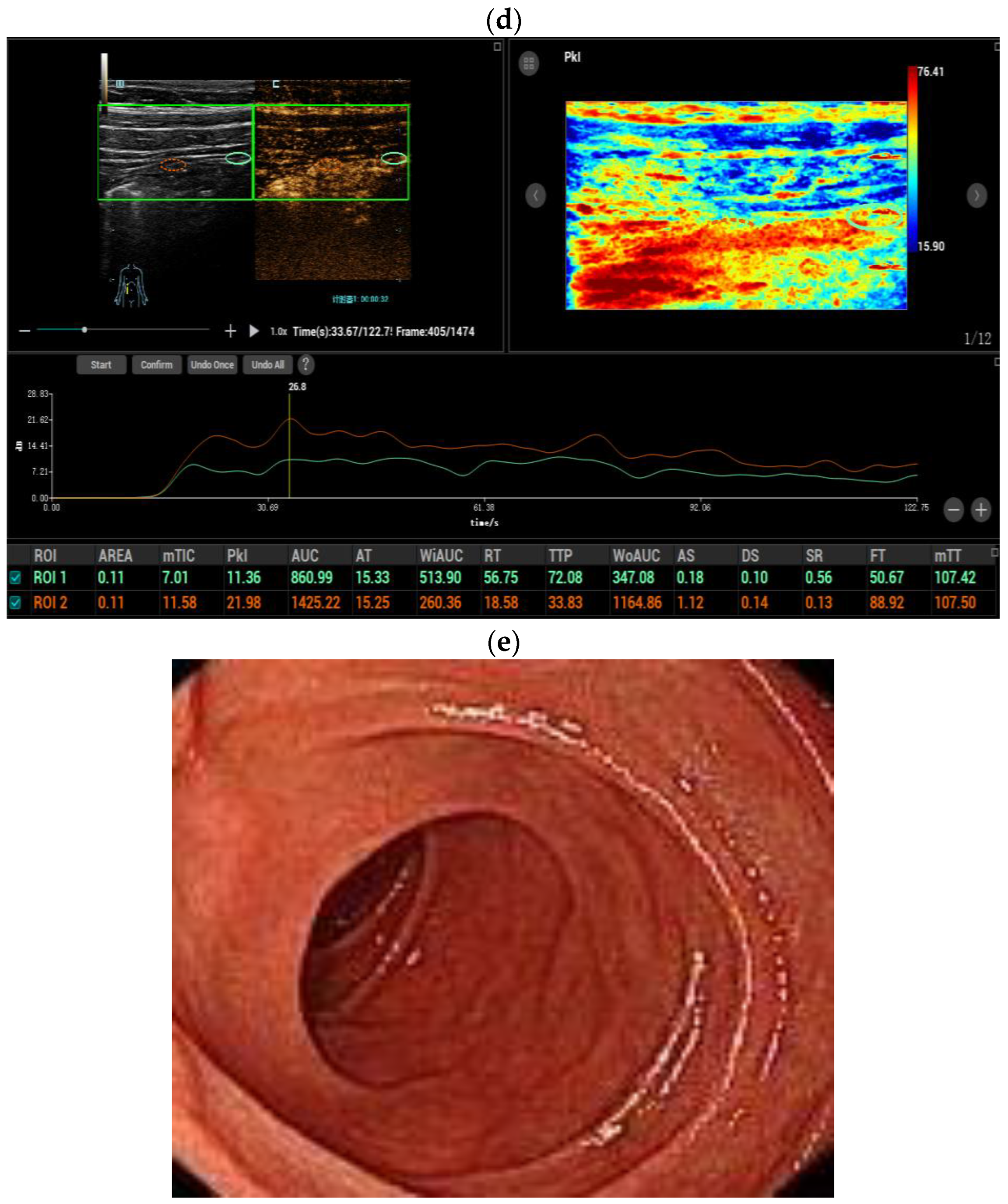 Diagnostics 14 00672 g003b